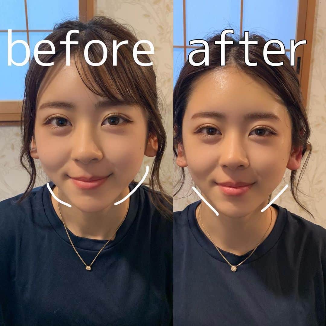 蛭川怜奈のインスタグラム：「今日はTotal body Support さんへ行ってきました！ リフトアップ効果と脱毛効果のある器械をやってもらいました！ 一回だけでこの効果！ 私のインスタ見た！と伝えてもらえれば2000円オフになるみたいなので是非行ってみてください〜！  さらに40分のヘッドスパもしてもらって爆睡かましてきました✨✨✨ 日頃の疲れが一気に取れました☺️ . . @viday_official  #viday #ヘッドスパ#pr」
