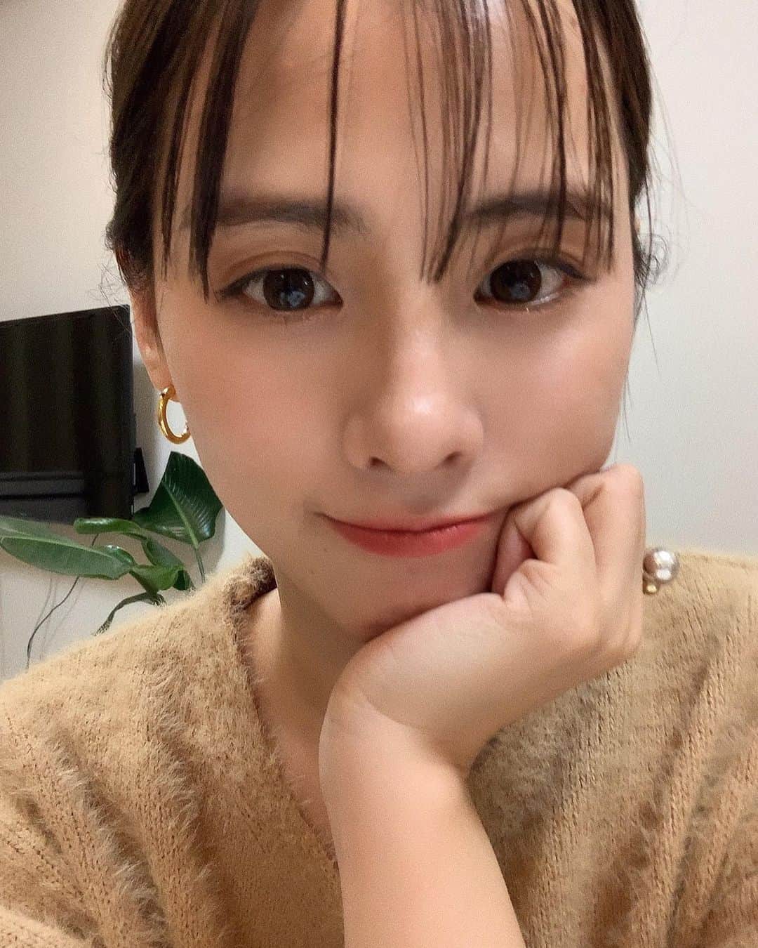 のインスタグラム：「. 30代に突入して、いよいよ 気になりだしたお肌の悩みを解決したくて 遂に、クリニックデビューしました！ . 今回は、成長因子を配合した トックスピールという 最新のピーリングを受けたんだけど とにかく即効性がすごい！ 終わった後から、くすみがとれて 肌がふっくらもっちり！ そして、慢性的にあった おでこのポツポツニキビが小さくなって ほほの毛穴の開きも気にならなくなった。 もう、これはちゃんと毎月通うと決めた！🥺 クリニック初めてで抵抗あったんだけど 色んな皮膚科行っても良くならなくて、 勇気出して行って本当によかった。 料金も本当に？って程安い！ 通常価格でも都内最安値レベルなのに 会員価格になると30%OFFになって、 モニターだと40%OFFになる！ 通いやすくてありがたい🥺🙏🏻 . 他にも美肌点滴やビタミン点滴もしてもらってルンルンで帰宅しました♡ 久しぶりに長文で熱く語ってるけど 案件ではなくて、本当におすすめなので コンプレックスや悩みがある方は是非行ってみてほしい。 先生もナースさんもすごく優しくて 肌荒れや、小顔、ダイエットなど色んなお悩みに優しく対応してくれるよ☺️✨ . #30代の美容事情」