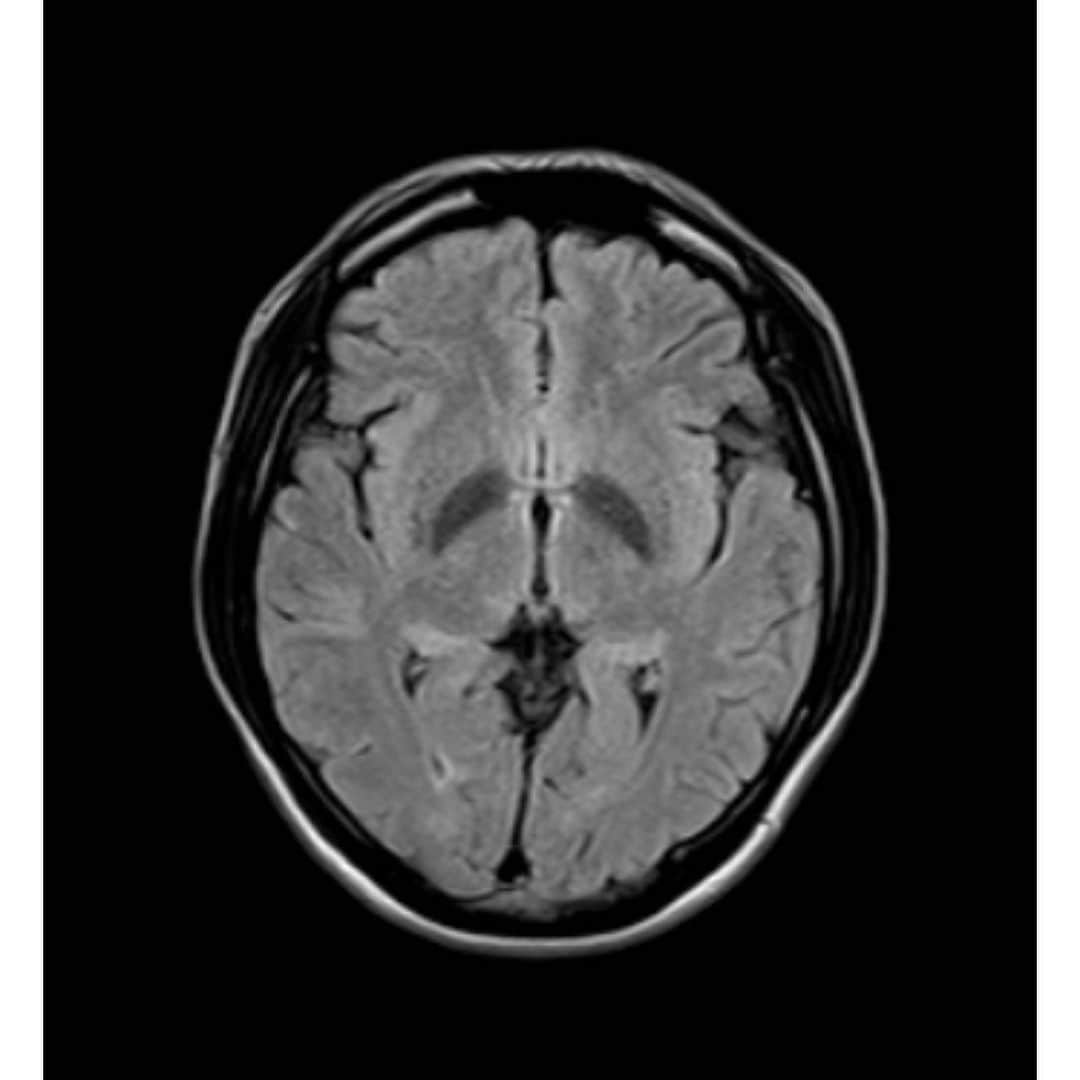 播戸竜二さんのインスタグラム写真 - (播戸竜二Instagram)「『スマート脳ドック』 ・ メディカルチェックスタジオ東京銀座クリニックに行きました！ ・ 初めての脳ドック！ 初めての肺のCT！ ・ 脳は問題ナシ👍 ・ 肺も問題ナシ👍 ・ 30分で終わっちゃう！ ・ 41歳には必要やね！ ・ 身体のケアは自分の為に！ ・ ・ #メディカルチェックスタジオ銀座 #脳ドック #肺のCT #問題ナシで安心 #この画像は恥ずかしい #目の手術もあったし #41歳人生の折り返し #いろいろチェックしないとね」11月22日 1時34分 - ryuji_bando