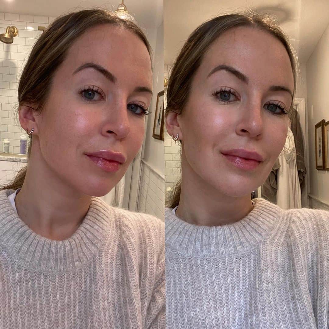 Helena Glazer Hodneのインスタグラム：「Have you ever heard of @opteskin? This little gadget uses blue light technology to naturally camouflage age spots, sunspots and hyperpigmentation on contact. Then overtime, the marks will naturally face with niacinamide, the key ingredient in OPTE's serum. If it still sounds a little confusing, I explain and show a lot more on my stories #ad, #OPTEskin #OPTEpartner」