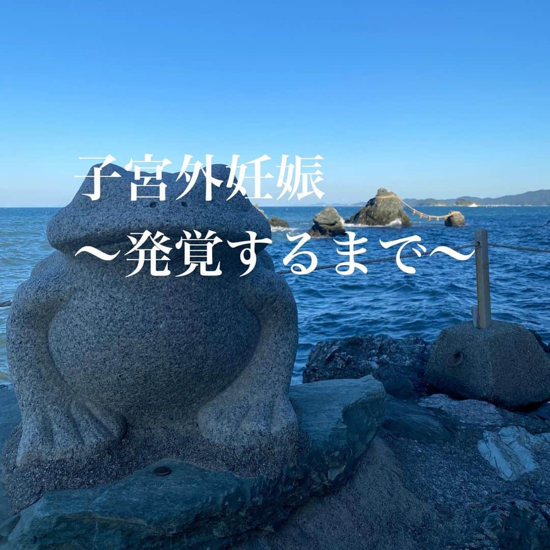朋未のインスタグラム：「悩みましたが この三ヶ月、たくさんの投稿を見てめちゃくちゃ参考になったので 私の経験も載せておきます。誰かの参考になれば..... (妊娠検査薬でてきます⚠️)  全妊娠🤰の1%が経験すると言われる 子宮外妊娠になりました。  不妊治療を今年の5月からはじめました。 今まで妊娠を経験したことがなく年齢も考え、妊娠できるのかどうかそれも含めて検査をしたかったからです。  風疹抗体がなく２ヶ月のお休みを経て、タイミング法を3回。ステップアップして人工授精を２回しました。 人工授精２回目で妊娠反応がでました。  生理が遅れることはここ数年全くなかったので、生理が遅れて５日目。はじめて検査薬をしました。  ２枚目⚠️  これ、線あるかなあ？あるよなあ？と旦那さんと話し合い 次の日、近所の産婦人科で調べてもらうと《陰性》  落胆して帰ったけれど  次の日、また次の日と少しずつ、検査薬は濃くなっていきました。  ネットで調べると化学流産の可能性が高いとのこと。  早々に、正常妊娠ではないんじゃないかと覚悟だけができました。  #子宮外妊娠 #化学流産 #hcg #不妊治療 #人工授精 #タイミング法」