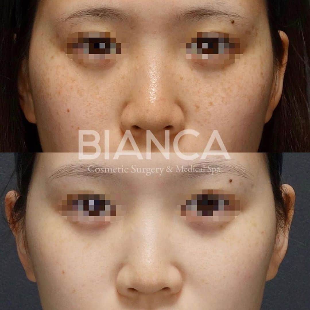 辻沢由有（BIANCA CLNIC 表参道院 院長）のインスタグラム