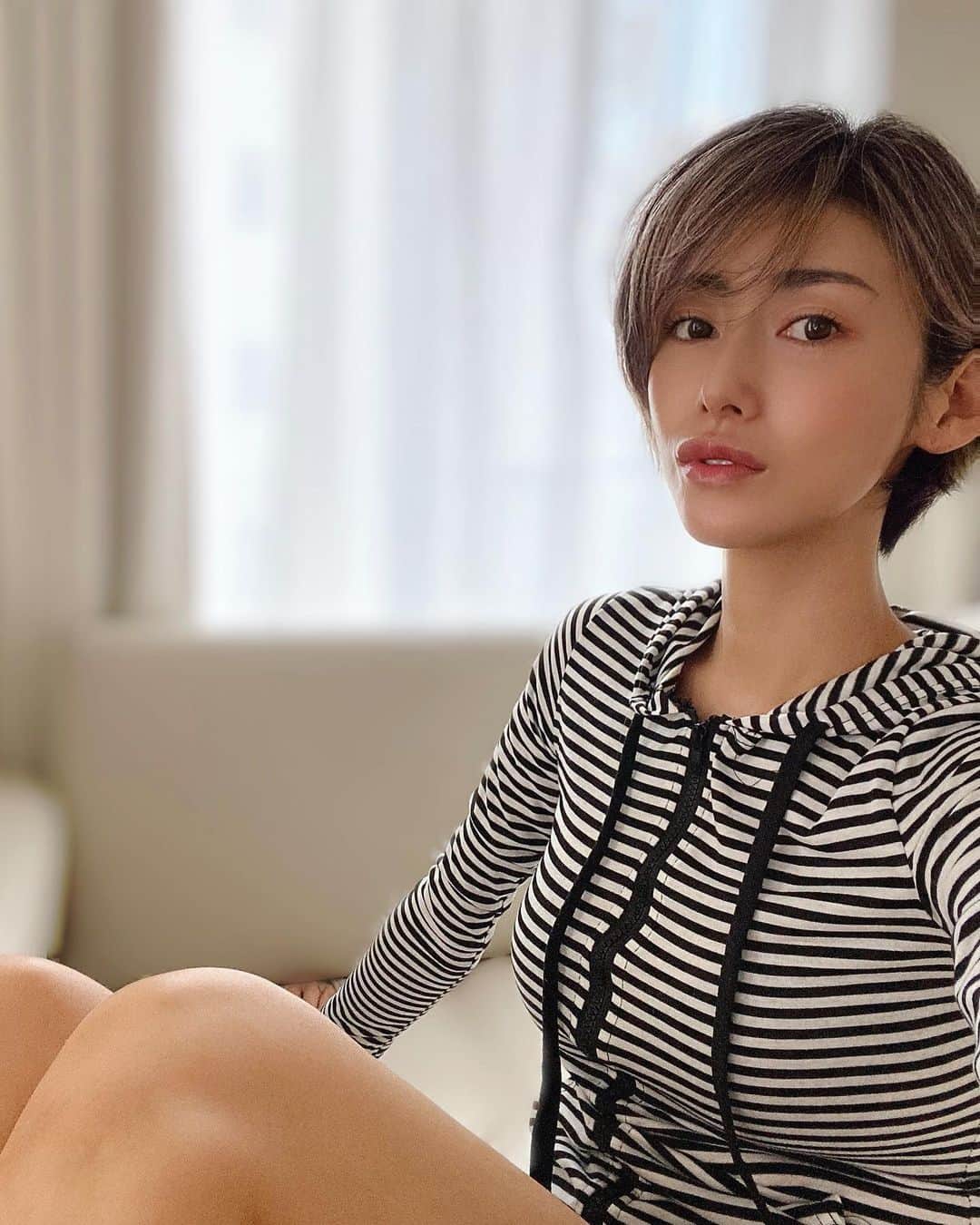 &mのインスタグラム：「眉上&こめかみの凸凹が気になってヒアルロン酸受けて1ヶ月くらい⁇ 顔に必要ない影が消えたかんじ。馴染んできてふんわり若くなったきがするよ👻💋」