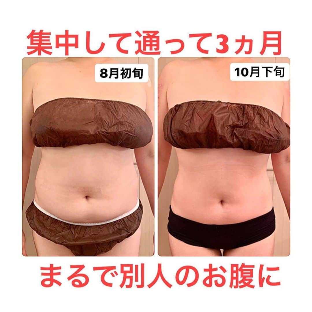 埼玉エステ＊インディバ＊戸田公園＊戸田市＊痩身＊冷え改善のインスタグラム：「「痩せたい‼︎」その想いで﻿ 一歩踏み出したお客様。﻿ ﻿ 自己流のダイエット法ではなく﻿ 一つ一つただ素直に着実に﻿ 取り組んでいただいた結果が﻿ こうしてしっかりと現れました😌﻿ ﻿ 【食事制限】ではなく【食事改善】に二人三脚で取り組み﻿ 「こんなに食べていいんですか⁉︎」と﻿ 驚かれながらも、楽しく取り組んでいただけました。﻿ ﻿ 体型を隠す洋服から、体にフィットした洋服を楽しめるようになり﻿ 表情も以前よりとてもイキイキとされています😊﻿ ﻿ 自己流ダイエットに限界を感じている方、﻿ しっかりとサポートさせていただきます😌﻿ ﻿ ﻿ ✴️結果にとことんコミットした﻿ 　【3ヵ月集中ダイエットコース】﻿ 　発表までもうすぐです❣️﻿ 　楽しみにお待ちくださいませ😊﻿ ﻿ ＿＿＿＿＿＿＿＿＿＿＿＿＿＿＿＿＿＿﻿ ﻿ 埼京線 戸田公園 徒歩8分﻿ 痩身専門サロン【ベルーヌ】﻿ ﻿ ご予約・お問い合わせは﻿ @misako.bell_nu﻿ トップページリンクより﻿ ﻿ 定休日　日・祝﻿ 営業時間　10:00〜17:00﻿ ＿＿＿＿＿＿＿＿＿＿＿＿＿＿＿＿＿＿﻿ ﻿ ﻿ #戸田市 #戸田公園 #戸田公園エステ #蕨　#武蔵浦和　#赤羽　#朝霞　#川口﻿ #インディバ #ダイエット#冷え改善　#体質改善　#体温アップ　#深部体温　#温活　#痩せたい　#痩せにくい　#痩せなくなった　#太りやすい　#サイズダウン　#お腹痩せ　#お腹引っ込めたい #ララガーデン川口　#北戸田イオン　#川口アリオ」