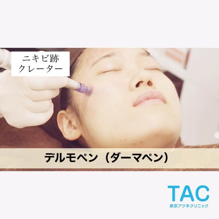 東京アクネクリニックのインスタグラム