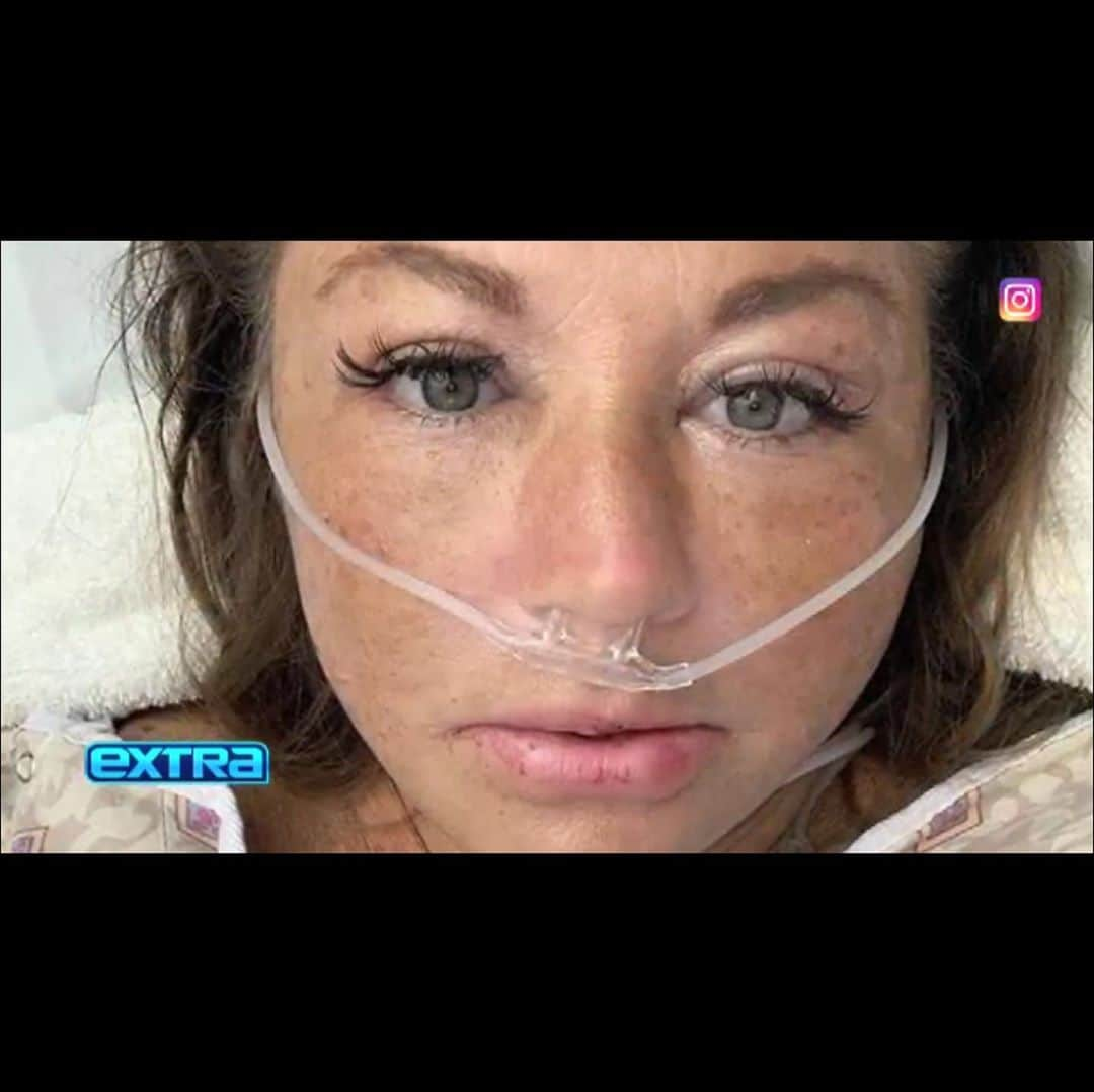 アビー・リー・ミラーさんのインスタグラム写真 - (アビー・リー・ミラーInstagram)「Watch @extratv tonight!!! Thanks so much to all the fabulous patient essential workers, medical staff, Dr Boudakian, Cal Rehab,  @missoscar22 @k8.singer and Dr Melamed @thespinepro @fgipr @samersaah & @extraingest1」11月5日 5時13分 - therealabbylee