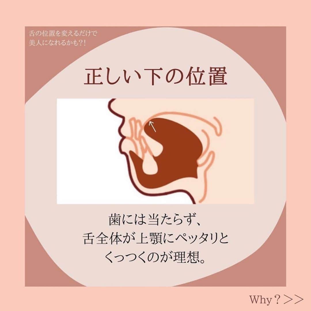 笑顔をリフォームする@健康小顔職人さんのインスタグラム写真 - (笑顔をリフォームする@健康小顔職人Instagram)「． 現在、巷で話題になっている舌の位置で小顔になる⁉️というトピックを @satoko_therapist ちゃんが分かりやすい画像と共に解説をしてくれています！ ． 皆さんの舌の位置はどうですか？改めて意識してみると面白いと思いますよ😆 ． ． #Repost @satoko_therapist with @get_repost ・・・ 【もっと詳しく‼️舌の位置を変えるだけで美人になれるかも？】﻿ ﻿ #舌の位置を正しい位置に変えるだけで美人になれるかも？﻿ ↑﻿ 以前の投稿でかなり反響があったので、﻿ もう少し掘り下げて再投稿させて頂きます！﻿ ﻿ 「骨格は骨で出来ているのに、本当に舌の力だけで全体のバランスが崩れるの？」﻿ と思う方もみえると思います。﻿ ﻿ 顔はいくつもの骨が繋がってできています。﻿ そして骨同士の連結部分は繊維質でできているので時間が経つにつれて少しずつ動いていきます。﻿ ﻿ 上顎骨は顔の大きな範囲を占める重要な部分。﻿ そのため舌の位置を変える事で徐々に骨格が変わる可能性があるのです💀✨﻿ ﻿ 既に海外では「舌の位置を変えようブーム」が起こっています。﻿ この方法は矯正専門医のマイク・ミュー博士の名前に因んで「ミューイング」と呼ばれています。﻿ ﻿ ミューイングを実施した写真をみてみると﻿ 頬骨、顎のライン、鼻の高さなど全体的に立体的な顔に変化していますよね👏﻿ ﻿ これはやはり、若ければ若いほど短期間で変化が現れるそうですが、成人後も顔が変わった事例が沢山あります。﻿ ﻿ 何故なら成人してからも骨の連結部分は完全に固まっていないからです！﻿ ﻿ 私たち(小顔職人 @kogao_shokunin ・小顔美容整体技士 @satoko_therapist )が行う小顔整顔と、﻿ ミューイングを併せて行えば、より早く結果が得られるはずです💆‍♀️✨﻿ ﻿ =============================﻿ ◼︎現役セラピストの私が本気で作った温活アイテム♨️﻿ #nakeda_alphaハーブパット﻿ ▷ @nakeda_alpha 残り僅か⚡️﻿ ﻿ ◼︎ @kogao_shokunin × @nakeda_alphaコラボ﻿ 『エンジェルハーブパット』👼✨﻿ ▷@happy_cosme_kogaoshokunin で好評発売中🌈﻿ =============================﻿ ﻿ #小顔美容整体技士﻿ #セラピスト﻿ #漢方ライフアドバイザー﻿ #ハーブパット作家﻿ #サトコラム﻿ #ミューイング」11月5日 10時08分 - kogao_shokunin
