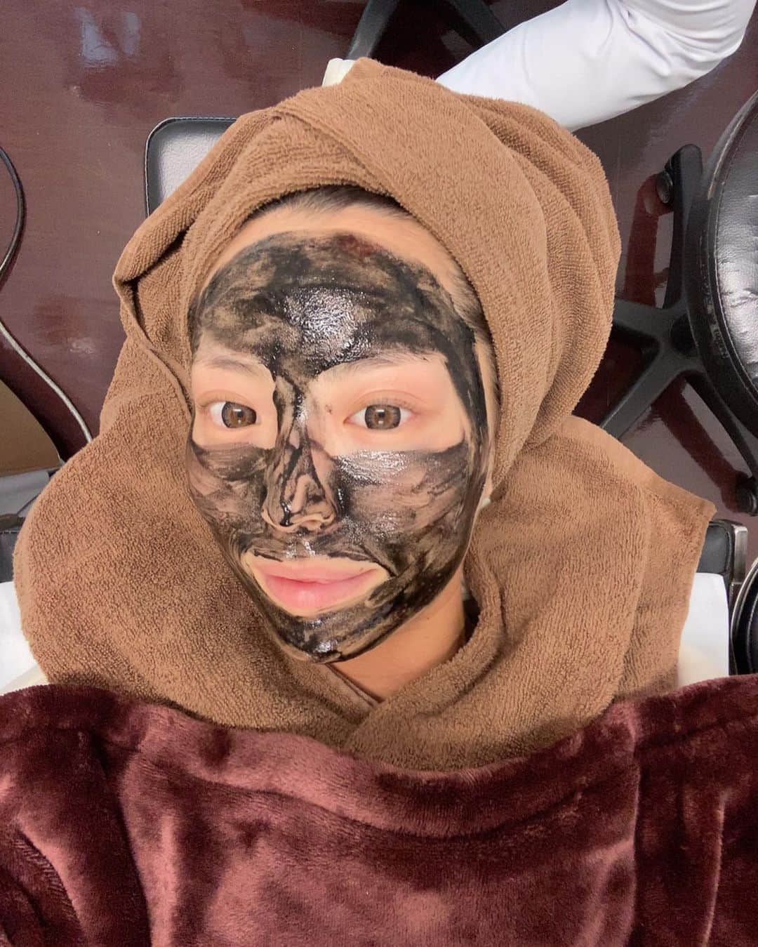 さーたんさんのインスタグラム写真 - (さーたんInstagram)「* * * 昨日のお話💖 @ikebukuro.west_sbc で ブラックピール ウルトラリフトダブルHIFU ベビースキン やっていただきました💆‍♀️✨ * ブラックピールはまじでつるっつるぴっかぴか 毛穴も綺麗になります🥺👏 ベビースキンはうるうるのお肌に🥰💖 医療って効果すごいわかるから嬉しなるぅ❣️ * ハイフは👦🏽にも毎度 「むっちゃ変わった‼️」 「またやっておいで‼️」 「次いつやるの？」←失礼wwww 言われるくらい。笑 糸が怖いわたしにはハイフがちょうどいい🤣🙏❤️ * もう30歳やからって諦めたくないし まだ30歳やからって言うてたらすぐ年取るし できる時にできることやらなきゃね💄🎀💆‍♀️✨ * * * #湘南美容外科 #湘南美容クリニック #湘南 #美容 #整形 #クイックコスメティークダブル #二重 #埋没 #ベビースキン #ブラックピール #ハイフ #ウルトラリフトダブル #小顔」11月5日 15時10分 - saachi_10