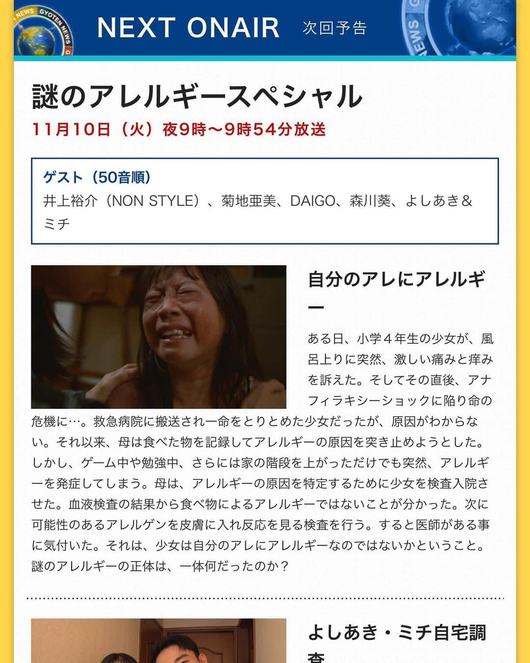 坂井丞のインスタグラム：「日テレ、ギョウテン‼️ コリン性蕁麻疹の特集見たいです！ 是非見て知っていただきたいと思います！」