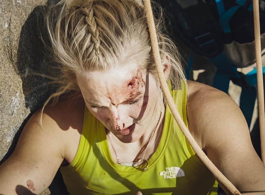 エミリー・ハリントンのインスタグラム：「Golden Gate ✨ Free 💫 In A Day ⚡️  📸 @jonglassberg / @jess_talley / @louderthan11   I never believed I could actually free climb El Cap in a day when I first set the goal for myself. It didn’t seem like a realistic objective for me. I didn’t have the skills, fitness, or risk profile to move so quickly over such a large piece of stone. But I chose it exactly for that reason. Impossible dreams challenge us to rise above who we are now to see if we can become better versions of ourselves.   On Nov 4 I started climbing  with @alexhonnold at 1:34am, caught between my own internal drama of achieving a life goal and the more prevalent one of the elections - both unfolding in parallel ways in my brain. I knew I was in for a big day - but that’s exactly why I was there. I wanted to find my limit and exist in it and fight beyond it.  A nasty slip on the 13a Golden Desert pitch almost took my resolve - a deep gash on my forehead left me bloody and defeated. I pulled on again, part of me not really wanting to stay on the wall, the other part gathering courage and flow. I kept thinking “why am I still hanging on?”   The next pitch was the A5 traverse, where I failed last year. This time it was not my limit. I fought hard but with flawless movements in the dark. I cried at the belay - it could happen this time....The final 5 pitches felt scary in my current state but I pulled over the final lip at 10:30pm in disbelief.   There’s a lot more to say but mostly I wanted to express my gratitude for the love and support from friends, family, and strangers. I feel the love so intensely right now. Thank you all 🙏🏻 Massive thanks to @alexhonnold for climbing with me over these years, you’ve inspired me to think bigger and believe in myself in ways you cannot imagine. To @jonglassberg for your friendship, creativity, and ability to capture a story while at the same time keeping it light and always fun. And finally to my best friend, partner, lover, fave human of all time @adrianballinger - your support and love for me through the darkness and the light has never wavered. I love you endlessly ❤️❤️❤️  More to come!!!  @thenorthface / @kodiakcakes / @petzl_official / @lasportivana」