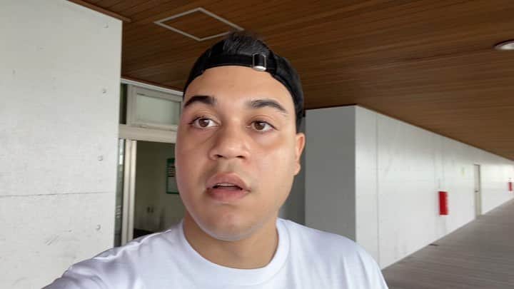 クリス（ありんくりん）のインスタグラム：「肌荒れ気になる人 クリスのケアの仕方教えます #クリスでーす」