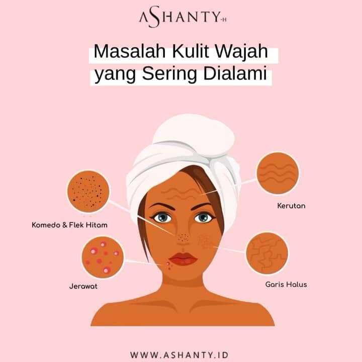 ASHANTY BEAUTY CREAM OFFICIALのインスタグラム：「Beberapa masalah kulit wajah yang sering dialami seperti komedo, flek hitam, jerawat, kerutan dan garis halus. Kenali kondisi wajah dan berikan perawatan yang tepat. Ashanty Beauty Cream memberikan solusi terbaik untuk atasi masalah kulit pada wajah. Dengan menggunakan rangkaian cream series by Ashanty, pilih dan sesuaikan kondisi kulit wajah agar mendapatkan perawatan yang tepat. Ada 3 Cream Series yang dapat kamu pilih dan sesuaikan dengan kondisi kulit wajahmu • Whitening Cream Series cocok untuk jenis kulit wajah yang kusam dan kering • Acne Cream Series cocok untuk jenis kulit wajah yang kusam, berminyak dan berjerawat • Anti Aging Cream Series cocok untuk usia 21 tahun keatas dengan kondisi kulit yang kusam, kombinasi (berminyak dan kering)  _____________________________ Informasi dan pemesanan  Ashanty Beauty Cream Chat Via WA : WA: 081293823950 WA: 081287388885 WA: 087778489900 WA: 085781140354 ⚡️ Fast Respons Click Link On Bio Instagram @ashantyid ❣️ ______________________________ #ashantybeautycream #creamashanty #skincareashanty #skincare #skincareartis #skincarelokal #creamwajah #creamperawatanwajah #obatjerawat #jerawat #kosmetik #krimwajah #creamwajah #whiteningcream #ashantyid #ashanty」