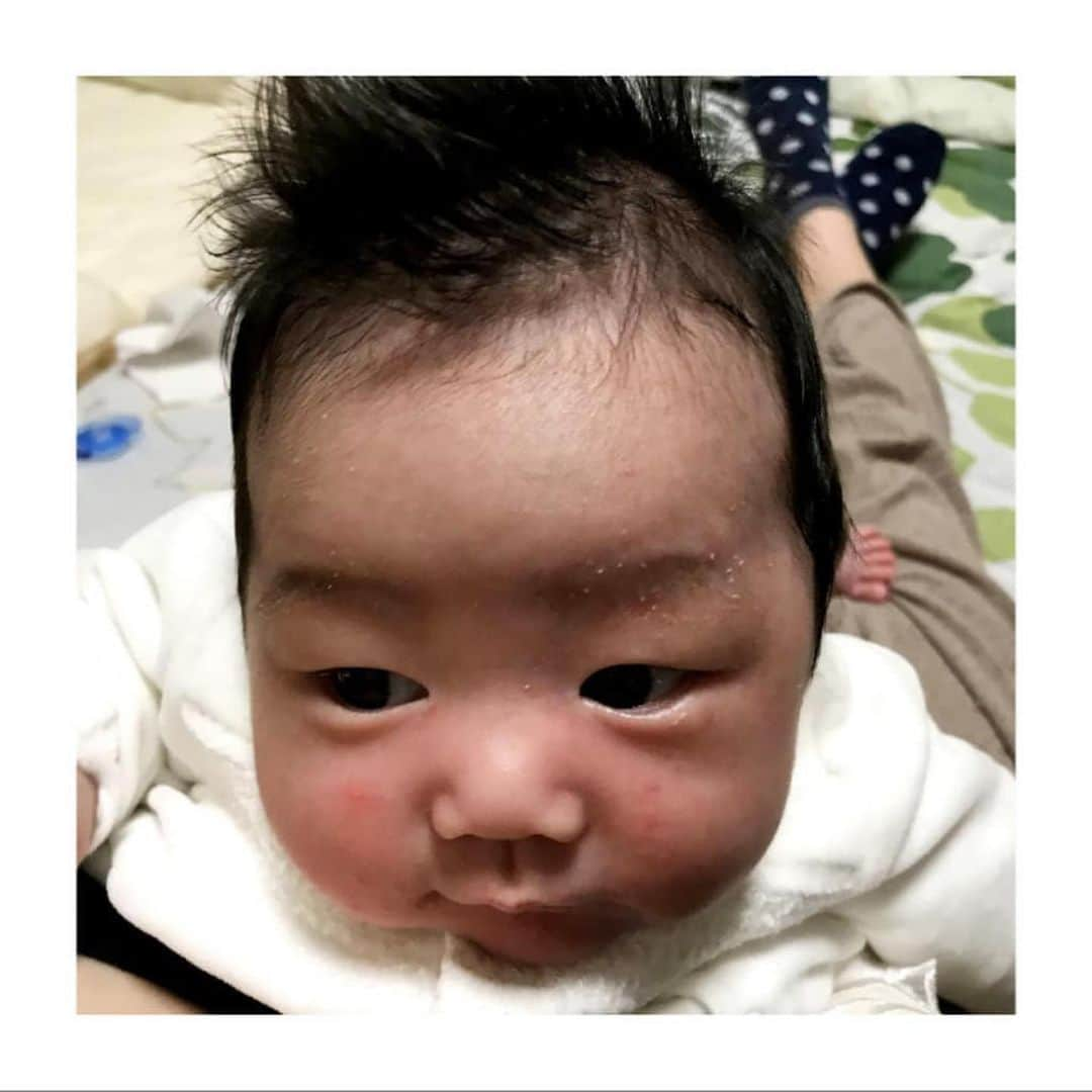 Fam's Baby ファムズベビーさんのインスタグラム写真 - (Fam's Baby ファムズベビーInstagram)「☁️☁️☁️  新生児期、生後2、3ヶ月をピークに多い乳児湿疹😢 心配になりますよね… お子様のスキンケアも合う合わないがございますからママも試行錯誤が必要になったりもしますよね😔  ファムズベビーは新生児期から#バリアスキンケア を勧めております☁️ 新生児期の頃からバリア機能を高める事が#アレルギーマーチ の予防に繋がります。  ※アレルギーマーチとは❓ 成長に伴い乾燥肌や湿疹から始まりアトピー、食物アレルギー、喘息、花粉症と連鎖的にアレルギー症状を引き起こす現象のことです。 ------------------------------------------☁️ Repost @may.nyan1004 様より素敵なご投稿お借りしました✨ ・・・ .  2枚目before  3枚目after . １ヶ月になる少しまえくらいから、 ポツポツガサガサ乳児湿疹がではじめてきて  沐浴じゃどうにもならないくらいになり、  旦那の妹さんにオススメしてもらった、 #famsbaby のエンジェルフォームを購入☁  早速使ってみると数日でみるみる綺麗になっていって感動しました⸜（⍥）⸝♡ 使い続けてからは乳児湿疹が出なくなりました😊❁  私的にひどい時はファムズベビーとワセリンを一緒に使ったら効果＆即効性抜群な気がする!!  母娘でスキンケアも出来て アトピー性皮膚炎の予防や効果もあるみたい🤝  ------------------------------------------☁️  【天使の羽キャンペーンについて】 ✨日本全国みんなで天使になって赤ちゃんもママも笑顔をつくりましょう！✨ 我が子が天使になる「カワイイ～♪」と思う気持ちで、日本中がほっこりする笑顔が増えたらとても素敵ですよね！　 皆様の参加をスタッフ一同心よりお待ちしています。 ☁️天使の羽キャンペーン内容☁️ ・#エンジェルフォーム （あわあわ）を使用し、天使の羽を作りインスタグラムへのご投稿をして頂けたら抽選で毎月10名様にファムズベビーシリーズの中からお好きな製品を1つプレゼント致します♪ ・#ファムズベビー でご投稿ください（その他参考：#おうち時間 #天使になろう #天使の羽キャンペーン ） ・非公開アカウントはこちらで確認できない為、ご参加不可となりますのでご了承くださいませ😢」11月25日 11時58分 - famsbaby