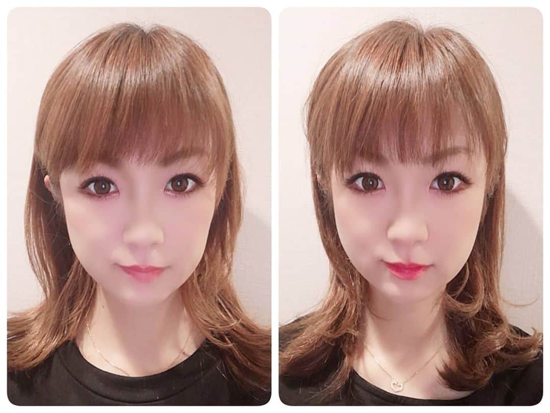 中島彩のインスタグラム：「ハイフ２回目❤️ @maison_de_m_misa で受けてきました😘 お写真は 左:１回目の直後 右:２回目の直後 お写真で見てもわかるくらい顔の幅が狭くなって、目の大きさにも変化😍 今回も重点的に気になる顎下のたるみをメインにお願いしました✨初おでこも✨ おでこにハイフあてるとキュッと持ち上がるので直後から目の大きさの変化わかりやすかった～💕 サロンで扱ってるエキスパートローションも購入❤️むくみに即効性があるとのことで、むくみ顔の朝に使うのが楽しみ💕  ハイフの威力が最高すぎて...やっぱり次の予約もしなきゃ😝  #ハイフ　#アンチエイジング　#エイジングケア #ビフォアフ　#ハイフエステ #ビフォアフ写真 #ビフォーアフター　#エステサロン　#阪急塚口」