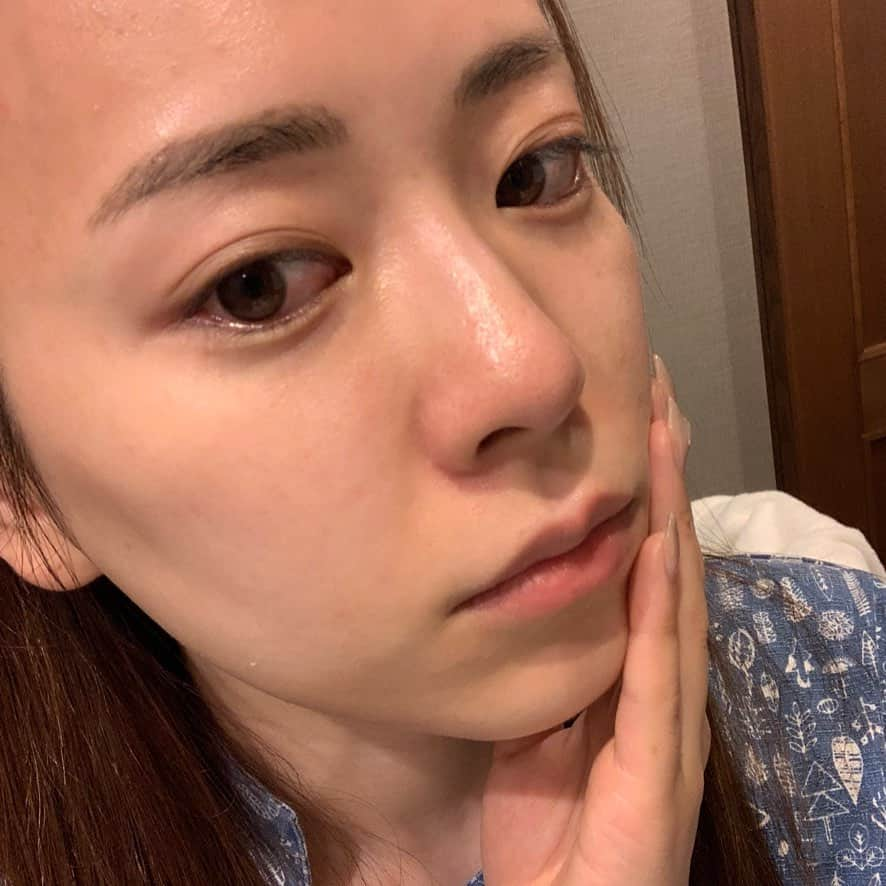 関根理紗さんのインスタグラム写真 - (関根理紗Instagram)「毛穴のひらき、つまりで悩んでるってコメントを本当によくもらうんだけど、今までやって1番効果あったかもという毛穴ケアに出会った🔥  青山ヒフ科クリニックでソニックウォッシュピーリングとハイパーエナジー導入をしたんだけど毛穴スッキリするだけじゃなくてめちゃくちゃ引き締まって小さくなった！！  ビフォー撮り忘れたのだけど、 標準カメラ無加工の写真です！  ハイドラフェイシャルとかもやったことあってあれも毛穴スッキリするし仕上がりがもちもちになるから好きなんだけど、毛穴の引き締まりはダントツで凄かったよ😭  ドクターケイのスキンケアを使うとより毛穴の状態が長持ちするってことで使ってみてるけど、全顔で使うとちょっと乾燥するかも🥺  特に冬だし、部分的に使ってみてもいいかなって思った！  下地で毛穴の凸凹埋めてくれるやつとかあるけど、ものによってはそれが角栓できやすくなったりするのもあるしスキンケアで毛穴小さくできるのがやはりベストだよね🦀  しばらく続けてみようと思います🔥  追記！ コースと金額わかりやすく追記しました！ 私のところから飛ぶと安くなるよってプロモーションできるほどビッグじゃなくてごめんだけどこんな感じです笑  ソニックウォッシュピーリング　15000円プラス税 ★イオン導入とのセット価格　12000円プラス税  ハイパーエナジー導入（イオン導入）9000円プラス税  #青山ヒフ科クリニック　#ドクターケイ　#ソニックウォッシュピーリング　#ハイパーエナジー導入　#イオン導入」11月11日 21時20分 - sekine.risa