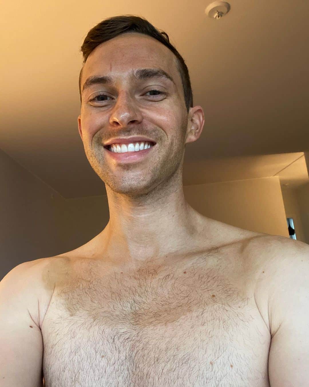 アダム・リッポンのインスタグラム：「Hi. I’m 31 today and as a birthday present to myself I tanned the top part of me to look ~*sun kissed*~ 🥳🥳🥳」