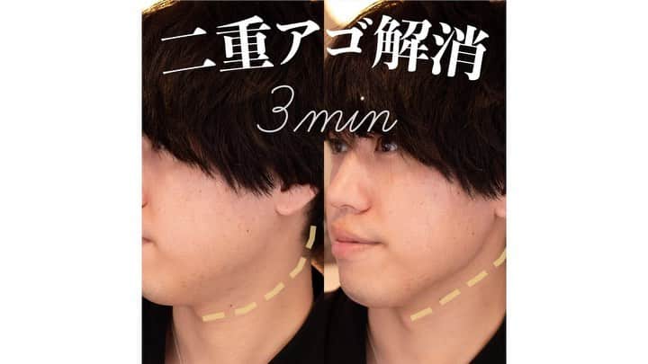 美容整体師川島さん。のインスタグラム：「あとから見返したい人は【保存マーク】で 保存していってください👨‍⚕️ 今回のような内容がいいな！って思った人は、 【いいねボタン👍🏻】で教えてください☺️ . ============================== . 【二重顎をアイドル級にすっきりさせる方法】 こんばんは、美容整体師の川島です👨‍⚕️ . 今回は、たるんだ顎をなんとかしたい… 二重顎をすっきり解消する方法です！ . POINTは、、、、 『皮膚』です。 , 皮膚や筋膜が張り付いていると 組織がうまく機能しなくなり弛んできます… . なので、しっかり皮膚や筋膜をはがし たるんでしまった皮膚をリフトアップさせます！ . ＜やり方＞ １、フェイスラインの皮膚を摘んではがします . ２、顎の下あたりの皮膚をはがします . ３、広頚筋というフェイスラインについてる 大きな筋肉を上下にほぐしていきます。 . まだまだ続きがありますが 内容が詳しく書くと盛り沢山で 書ききれないので . 詳しく知りたい人は Youtubeでも見てみてね😎 . . 【施術案内】 二重整体術や小顔矯正の施術が受けれる サロン情報はプロフィールからクリック🔍 ↓↓↓ @biyou_kawashima .  #整体KAWASHIMA #整体Filament #川島悠希 #整体 #美容 #顔 #小顔 #マッサージ #整形 #小顔メイク #二重顎 #顎 #ダイエット #ダイエットメニュー #ダイエット記録 #ダイエットアカウント #ダイエット生活  #ダイエット女子 #ダイエット仲間と繋がりたい #ダイエット方法 #ダイエット部  #美容女子 #キレイになりたい #美容部 #美活 #自分磨き #beauty #美活女子 #ダイエット #宅トレ」