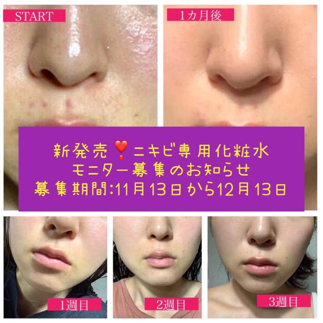 veggy_ambassadorさんのインスタグラム写真 - (veggy_ambassadorInstagram)「新発売❣️ニキビ専用化粧水﻿ モニター募集のお知らせ﻿ ﻿ 美肌菌（皮膚常在菌）を育てて肌フローラのバランスを整えながらニキビの悩みを改善してみませんか？﻿  ﻿ ご興味ある方はアカウントURLよりご応募ください。﻿ ﻿ ①募集期間：2020年11月13日(金)〜12月13日(日)23:59まで﻿ ﻿ ②募集人数：20名﻿ ﻿ ③@hatsuga_recruiting 公募用ページURL下部フォームから応募後、弊社にて審査を行わせて頂きます。﻿ ﻿ ④お顔のニキビでお悩みの18歳〜40歳の女性﻿ （青春ニキビ、大人ニキビでお悩みの方)﻿ ﻿ ⑤商品到着より3ヶ月間﻿ お顔の写真を提出いただける方。﻿ （治療前の写真＋2週間毎に経過報告写真）﻿ ﻿ ⑥モニター期間中﻿ 朝晩の2回しっかりと化粧水をご使用頂ける方。﻿ ﻿ ⑦お顔の写真を症例写真として使用OKな方﻿ (プライバシー保護のため目隠し加工をさせていただきます。症例写真としてブログやSNSに搭載する事をご了承ください。)﻿ ﻿ こんな方のご応募をお待ちしています！﻿ ﻿ 1	クリニックなどの治療では十分に効果の得られなかった方﻿ ﻿ 2	ナチュラルコスメを取り入れながら、肌に優しくニキビを治したい方﻿ ﻿ 3	敏感肌やアトピーで使用出来るスキンケア製品がない方、肌に合うかどうか心配で使用できない方﻿ ﻿ 4	ケミカルなコスメが苦手な方、添加物を避けたい方﻿ ﻿ 【ニキビ専用化粧水体験モニターの特典】﻿ ﻿ 「ニキビ専用化粧水）」（15ml×6本）3ヶ月使用分をご自宅にご郵送いたします。﻿ ﻿ ご不明な点がございましたらアカウントより事務局までメッセージにてお問い合わせください。﻿ ﻿ ニキビ専用化粧水モニター管理事務局﻿ ﻿ 株式会社はつが﻿ info@veggy-life.com﻿ ﻿ #ニキビ﻿ #ニキビケア﻿ #ニキビ専用化粧水﻿ #株式会社はつが﻿ #veggybeauty﻿」11月13日 11時43分 - nadeshiko_official_shop