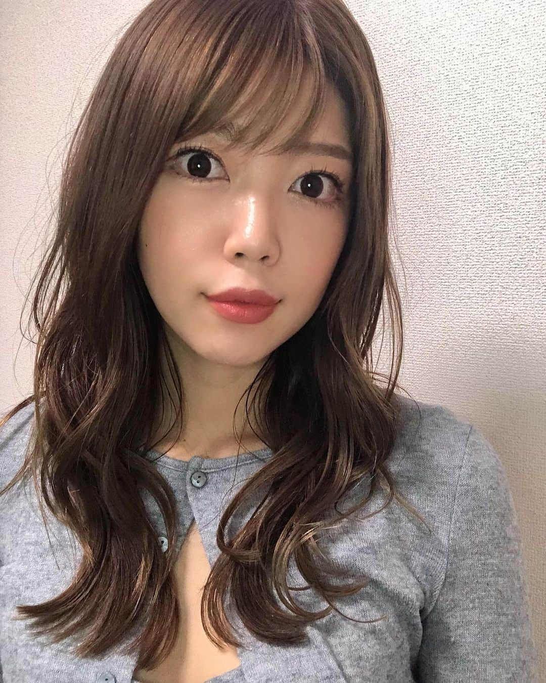 新庄千歳さんのインスタグラム写真 - (新庄千歳Instagram)「最近自分磨きがんばり中！ I try to become more attractive as a female❤︎ ってことで先日　@pruge_clinic さんでぷるぷる注射💉を私はクマとほうれい線にしてきました✨ ぷるぷる注射とは自分の血液から作製する、究極の若返り再生医療❤︎  自分の血液やからめっちゃ安心感あるよな！めっちゃ痛いやろなって思ってびびりまくってたけど、全然我慢できる痛さやった✨これも　@dr_okamoto 岡本先生がめっちゃお上手やからやな！ほんまに職人技です😆👌 お肌もぷるぷるなって綺麗になってきたし、目元も明るくなったし、ほうれい線も薄くなっていい感じちゃう？？ほんまにおすすめの若返り治療です‼︎  ⚠️クマがわかりやすいから3枚目にbefore after  載せてるよ！(ノーマルカメラ)  #ぷるぷる注射 #プルージュ美容クリニック#PRP  #美容クリニック#美容　#再生治療 #若返り治療　#クマ治療#ほうれい線#beauty #cosmeticsurgery」11月13日 12時20分 - chii_in_miami