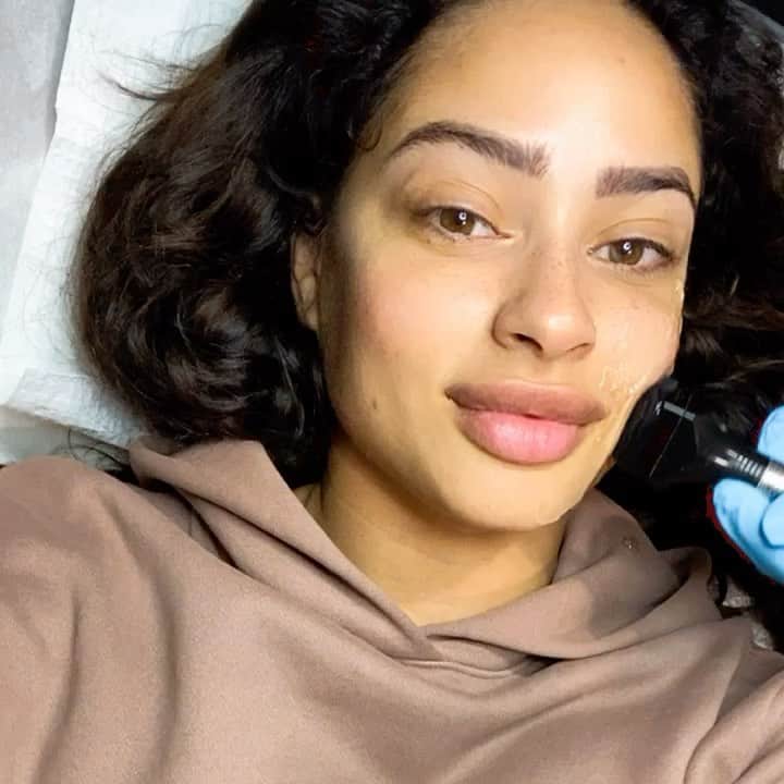 のインスタグラム：「@doctorrahimd FORMA Facial is the BEST ! 😩🥰✨」