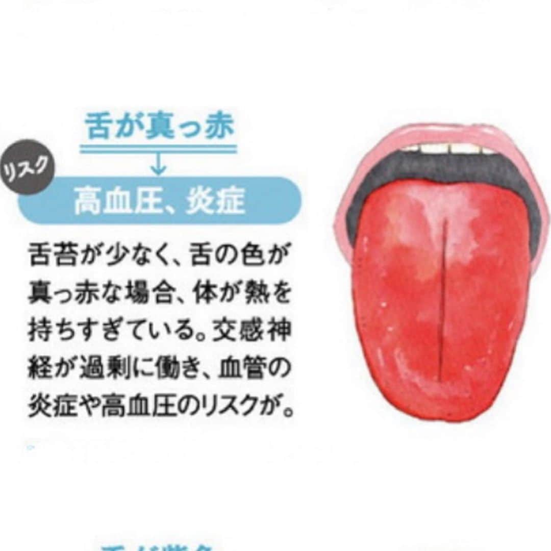 kogao283さんのインスタグラム写真 - (kogao283Instagram)「自分の舌を観察したことがありますか？　 毎日鏡の前に立つことはあっても、 ぐっと鏡に近づいて大きな口を開け、 舌の色や形を観察することはなかなかないでしょう。  舌は粘膜に覆われ血管がたくさん集まっているため、 昔から中国医学では舌は その人の体質や内臓の状態を映し出す「鏡」と考えられ、 「舌診」という健康状態を診断する方法がありました。  舌の表面の細胞は新陳代謝が盛んで、 ３日ほどで再生するといわれています。  そのため、体調の変化に対しても反応が出やすくなります。  定期的に舌の状態をチェックすることで、 身体の不調のサインや、病気の早期発見につながるかもしれません。」11月14日 18時55分 - kogao283