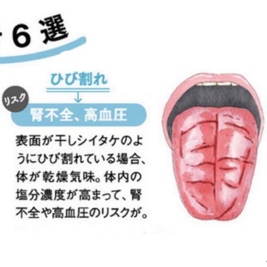 kogao283さんのインスタグラム写真 - (kogao283Instagram)「自分の舌を観察したことがありますか？　 毎日鏡の前に立つことはあっても、 ぐっと鏡に近づいて大きな口を開け、 舌の色や形を観察することはなかなかないでしょう。  舌は粘膜に覆われ血管がたくさん集まっているため、 昔から中国医学では舌は その人の体質や内臓の状態を映し出す「鏡」と考えられ、 「舌診」という健康状態を診断する方法がありました。  舌の表面の細胞は新陳代謝が盛んで、 ３日ほどで再生するといわれています。  そのため、体調の変化に対しても反応が出やすくなります。  定期的に舌の状態をチェックすることで、 身体の不調のサインや、病気の早期発見につながるかもしれません。」11月14日 18時55分 - kogao283