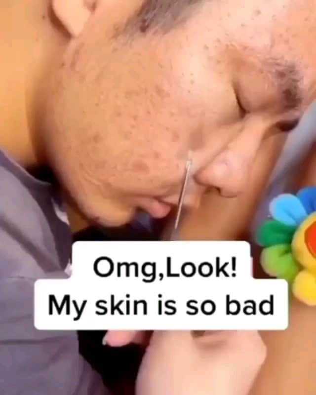 wonderful natureのインスタグラム：「This Blackhead Deep Cleansing Mask Can Help Removes Your Blackhead Within Minutes. Perfect For Skin Cleaning! - Order Link in bio of @paradigm__store . #fashiongoals  #fashionlove  #fashionphoto  #fashionbeauty  #fashionsta  #fashionistastyle  #fashionislife  #fashionism  #fashionismylife  #fashionforgood  #fashionforlife  #fashiontoday  #fashionforever  #fashionforyou  #beautytime  #fashiontime  #forbeauty  #forfashion  #loveforfashion  #lovefashionstyle  #lovefashion  #fashionblogg  #fashionismypassion  #fashiondresses  #beautyforlife  #beautytogether  #beautyispower  #beautyismybusiness  #fashionvideos  #fashionvideo」