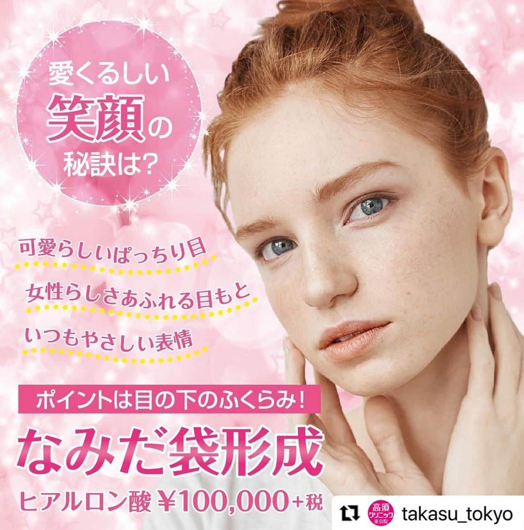 高須クリニックのインスタグラム：「. ━･･━･･━･･━･･━･･━･･━ #Repost @takasu_tokyo ━･･━･･━･･━･･━･･━･･━ 笑った時の目の下のふくらみ“なみだ袋”。﻿ 愛くるしい笑顔の重要なポイントになっています。﻿ ふっくらとたおやかな目のふくらみは、ヒアルロン酸を目の下に注入して作ります。﻿ ヒアルロン酸の場合は、約1年間十分な効果が持続し、約2～3年かけて徐々に体内に吸収されます。﻿ ﻿ 【🌿料金】﻿ ●なみだ袋形成（ヒアルロン酸注射）﻿ ￥100,000（税抜）［全院］﻿ ﻿ 【⚠️副作用・リスク】﻿ ●なみだ袋形成（ヒアルロン酸注射）﻿ 内出血（注射針が血管に当たってしまった場合）、仕上がりのわずかな左右差（完璧なシンメトリーは不可）、仕上がりが完璧に自分の理想の形にならないことがある、アレルギーが生じる可能性、注入後の感染、過度にいじったり揉んだりすると腫れる可能性﻿ ﻿ 【ご予約・お問合せ】 ➿0120-5587-10 ※症例写真や施術に関するご質問なども上記までお願い致します。 ﻿ #高須クリニック　#高須克弥　#美容　#美容整形　#整形　#プチ整形　#整形したい　#美容外科　#美容クリニック　#かわいい　#可愛くなりたい　#綺麗　#綺麗になりたい　#美人　#美容好きな人と繋がりたい　#美容好き　#目　#目元　#目もと　#涙袋　#なみだ袋　#顔の印象　#笑顔　#可愛い　#eye」