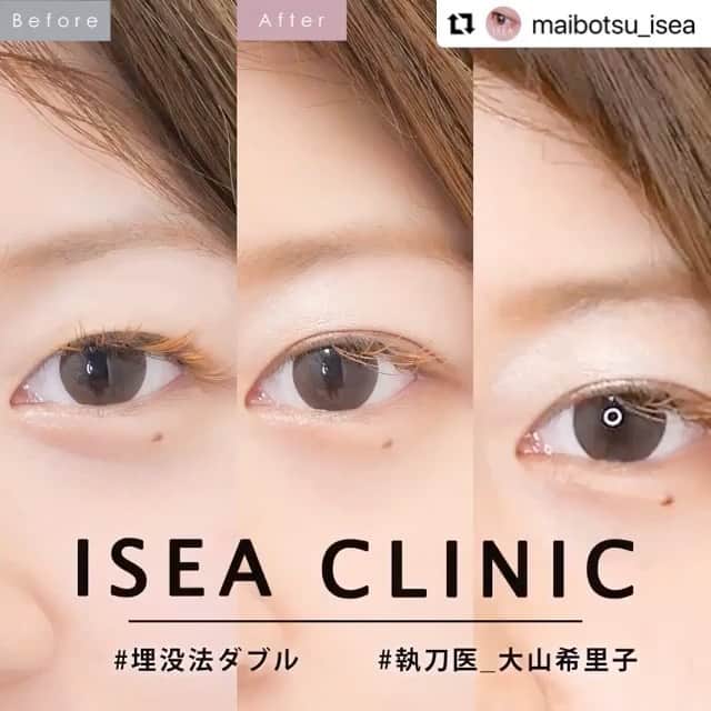 東京イセアクリニックのインスタグラム