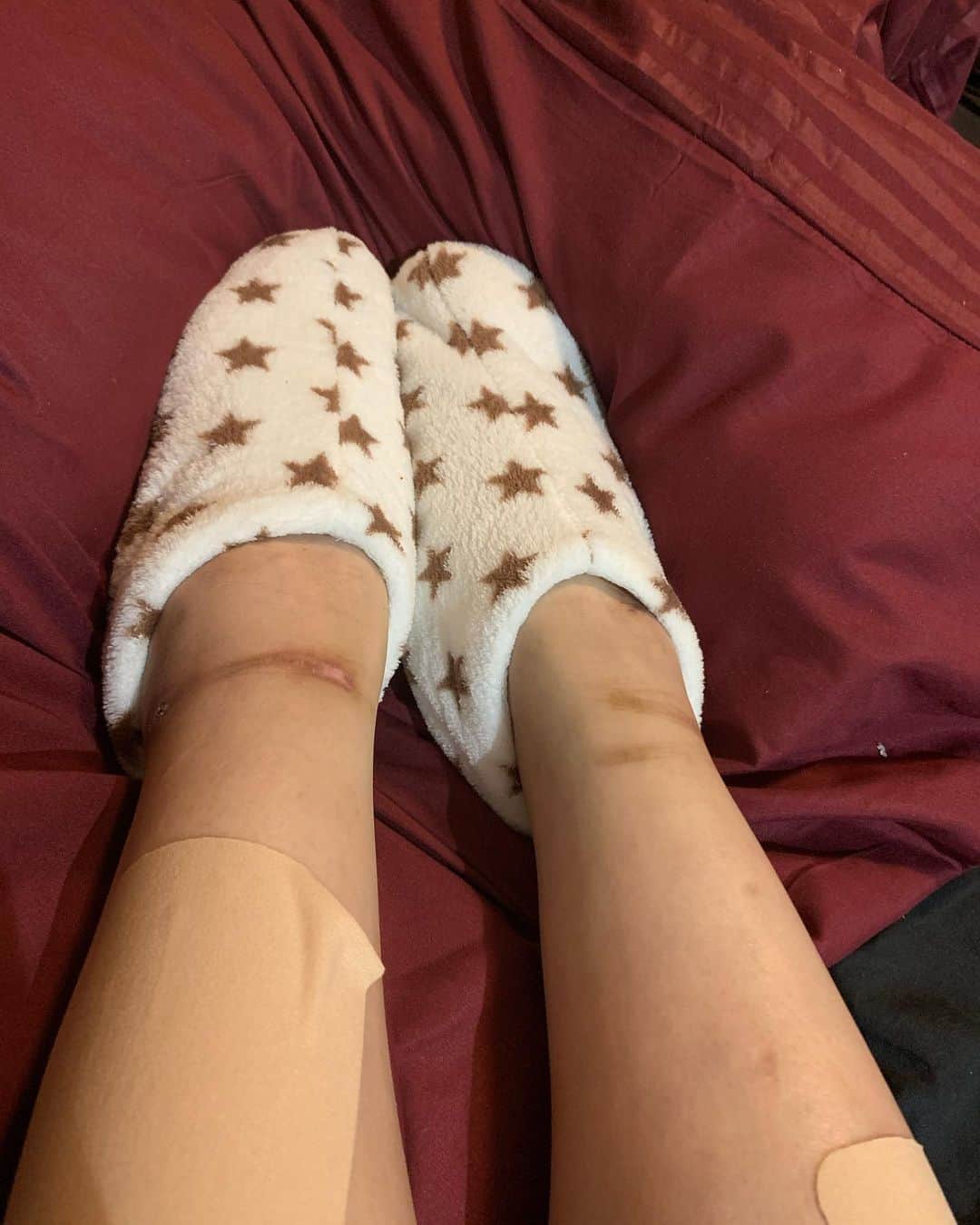 坂口杏里のインスタグラム：「モコモコ靴下🧦 あったか〜♡  09054307175  ↑何かあればこちらまで！ Bar Cachette (カシェット) 東京都新宿区歌舞伎町2-11-7 メトロビル4階 営業時間 1:00～7:00  お待ちしてますん💕 男性１時間3000円 女性１時間1500円 （飲み放題）  ライン交換、写メ撮ろ💕 さぁて！今日もー！ 飲むしか！  あ、この足の傷跡の真相はまた後日！ 今はバタバタなので詳しくちゃんと書きます！」