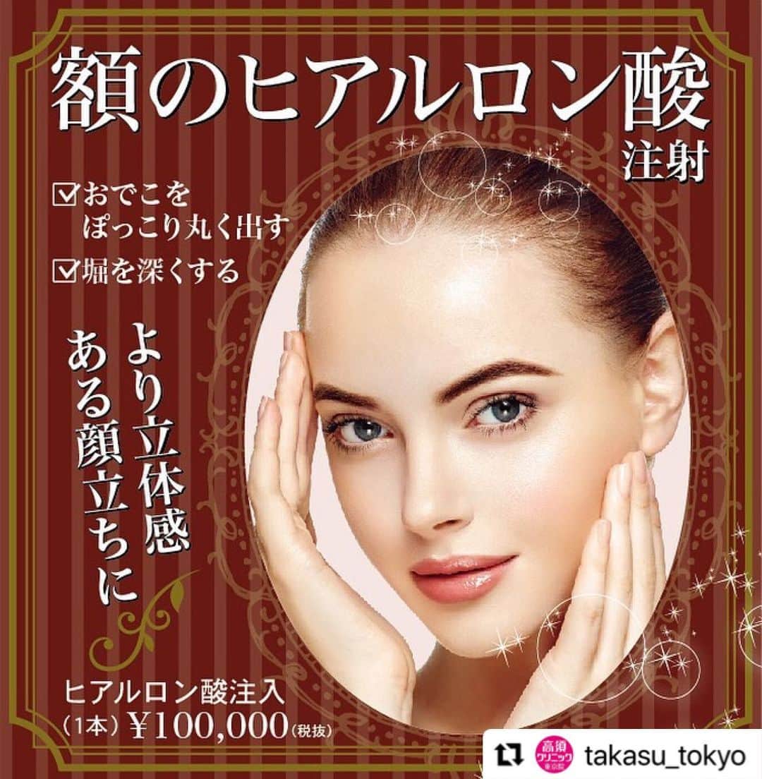 高須クリニックのインスタグラム：「. ━･･━･･━･･━･･━･･━･･━ #Repost @takasu_tokyo ━･･━･･━･･━･･━･･━･･━ 額のヒアルロン酸注射﻿ ﻿ 額が扁平だと、顔全体が淋しい印象になったり、実年齢より老けて見られることがあります。額に丸みを与えるだけでフェイスラインの印象はがらりと変わり、美しく整った顔立ちへ。﻿ 額に立体感を出す方法は手術（骨セメントの挿入）が一般的ですが、メスを使うのに抵抗があるという方も。そこで、このヒアルロン酸注入。額のふくらませたい部分に注射によってヒアルロン酸を注入するだけで、なりたい額の形を作ることができます。﻿ 額に微妙な凹凸がある場合も、ヒアルロン酸を注入することでなめらかに。注入したヒアルロン酸は約1年十分に効果が持続し、2～3年かけて徐々に体内に吸収されていきます。﻿ ﻿ 【料金】﻿ ●額のヒアルロン酸注射（おでこをぽっこり丸く出すor堀を深くする）﻿ ヒアルロン酸注入　1本 ¥100,000﻿ 【全院】﻿ ﻿ 【リスク・副作用・合併症】﻿ ●額のヒアルロン酸注射（おでこをぽっこり丸く出すor堀を深くする）﻿ 内出血（注射針が血管に当たってしまった場合）﻿ 仕上がりのわずかな左右差（完璧なシンメトリーは不可）﻿ 仕上がりが完璧に自分の理想の形にならないことがある﻿ アレルギーが生じる可能性﻿ 注入後の感染﻿ 血流不全、皮膚壊死﻿ 過度にいじったり揉んだりすると腫れる可能性﻿ ﻿ ﻿ 【ご予約・お問合せ】 ➿0120-5587-10 ※症例写真や施術に関するご質問なども上記までお願い致します。  #高須クリニック　#高須克弥　#美容　#美容整形　#整形手術　#整形　#プチ整形　#整形したい　#美容外科　#美容クリニック　#東京　#かわいい　#可愛くなりたい　#綺麗　#綺麗になりたい　#美人　#美容好きな人と繋がりたい　#美容好き　#おでこ　#額　#ヒアルロン酸　#おでこの丸み　#シワ　#輪郭　#フェイスライン　#エイジングケア」