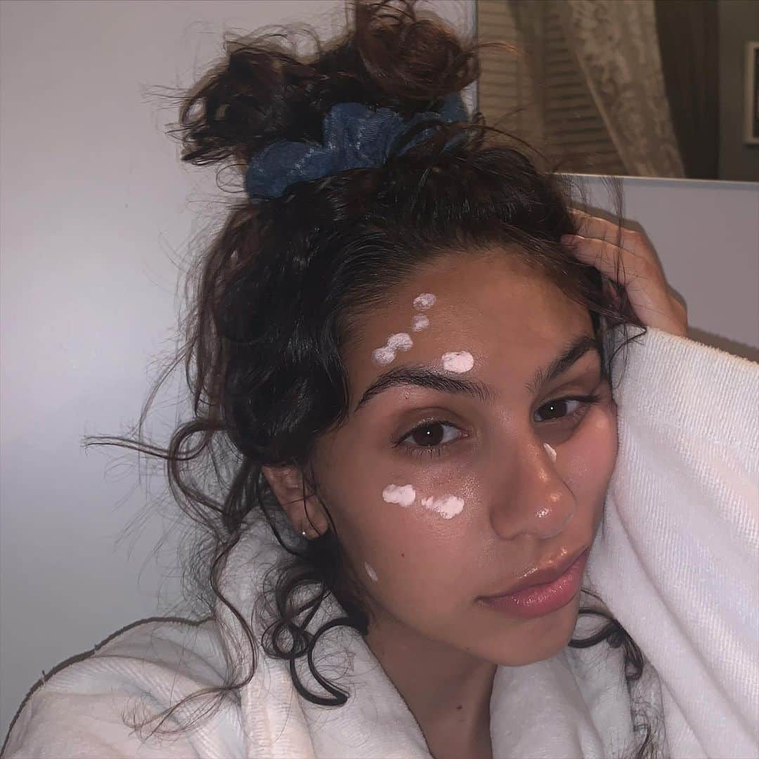 アレッシア･カーラさんのインスタグラム写真 - (アレッシア･カーラInstagram)「natural as it getsss. shoutout winter breakouts. thanks @torikelly🖤 passing this on to everyone. lemme see your cute faces :-) #AsSheIs」11月19日 5時27分 - alessiasmusic