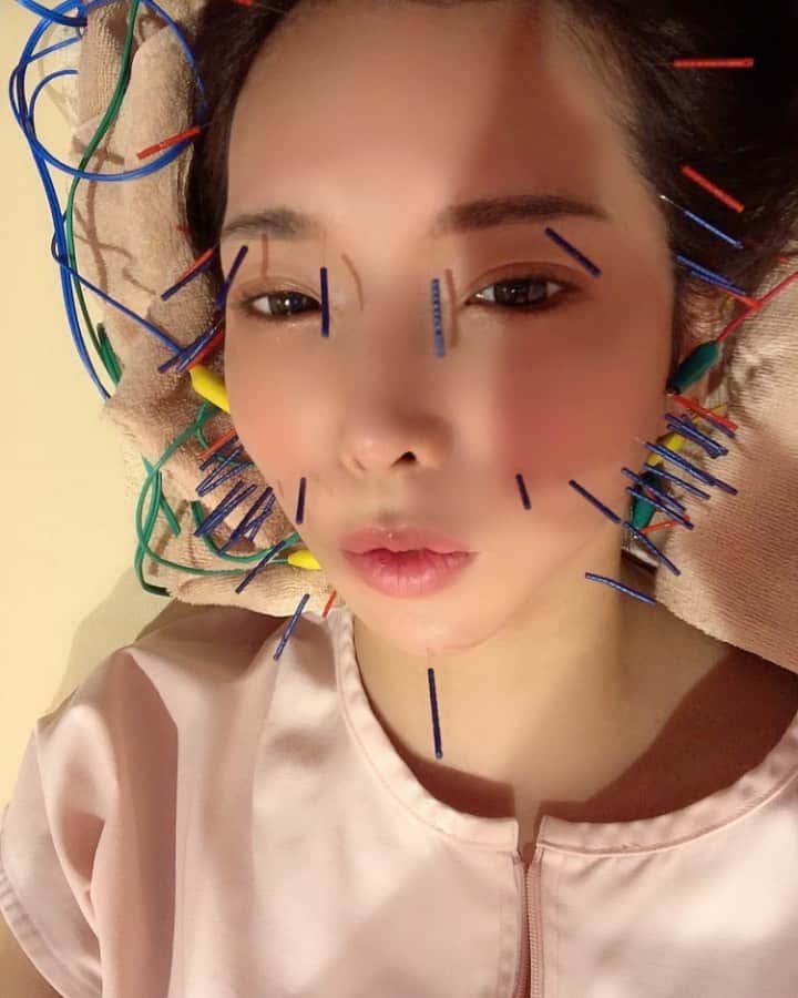 早川瀬里奈のインスタグラム：「美容鍼で電気通すやつ、やった直後はよくわかんなかったけど翌日の顔の調子良過ぎてやばい🤣🤣 ゴルゴ線消滅しとる @sbc.tokyo  でも美容より経絡鍼灸メインで通う😊」