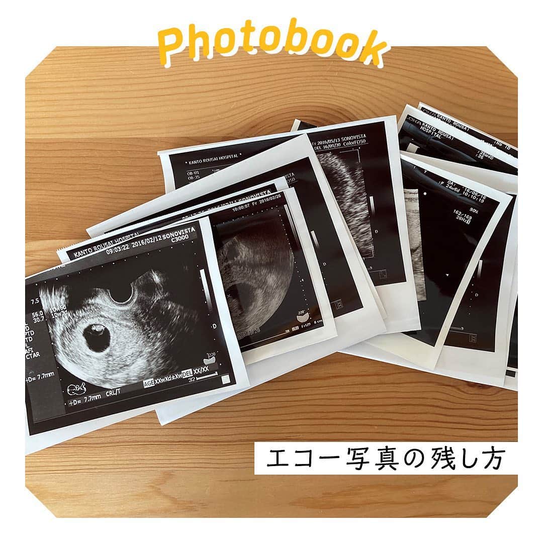 しまうまプリント 公式 フォトブック無料企画開催中さんのインスタグラム写真 しまうまプリント 公式 フォトブック 無料企画開催中instagram エコー写真を形に残しませんか エコー写真は感熱紙なので時間が経つと消えてしまいます それなら フォト