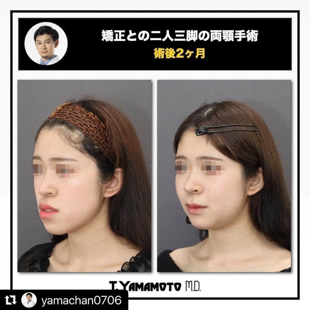 東京美容外科公式のインスタグラム