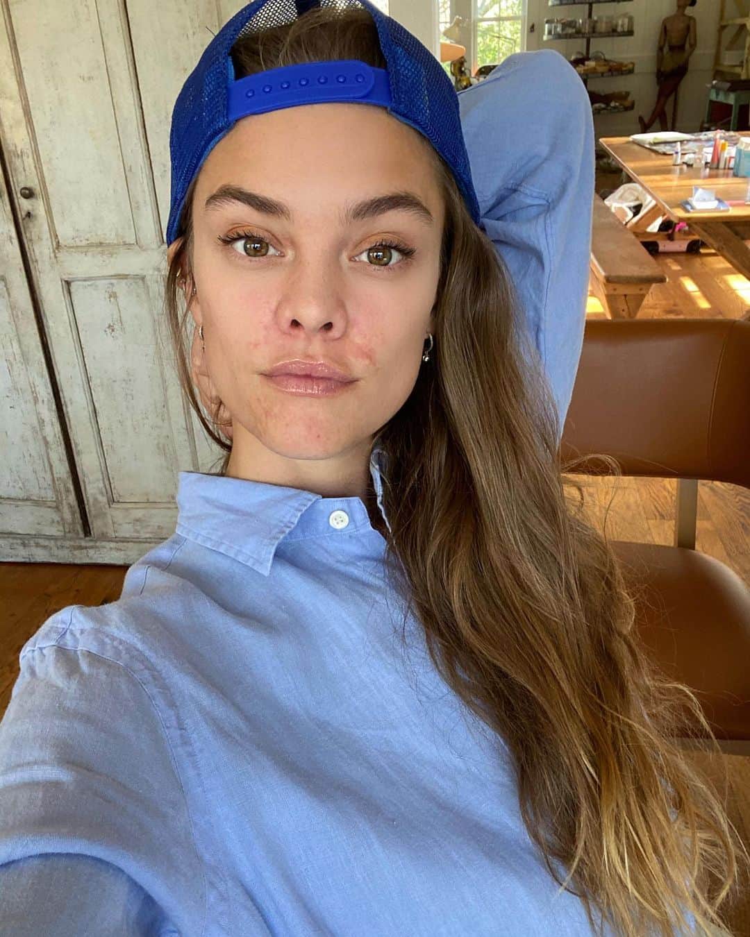 ニーナ・アグダルのインスタグラム：「Well hello there, perioral dermatitis! Can’t say I’m excited about it.. What I can say is that it’s made me appreciate the days where my skin is clearing up and not itching or burning (anyone else out there knowing what I’m talking about, specially when wearing a mask?) It’s also given me an opportunity to remind myself that what you/I see on the outside does not define me or my self worth 🤜🤛❤️ (ps. these pics are a few weeks old but wanted to share)」