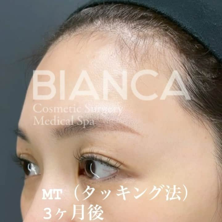 辻沢由有（BIANCA CLNIC 表参道院 院長）のインスタグラム