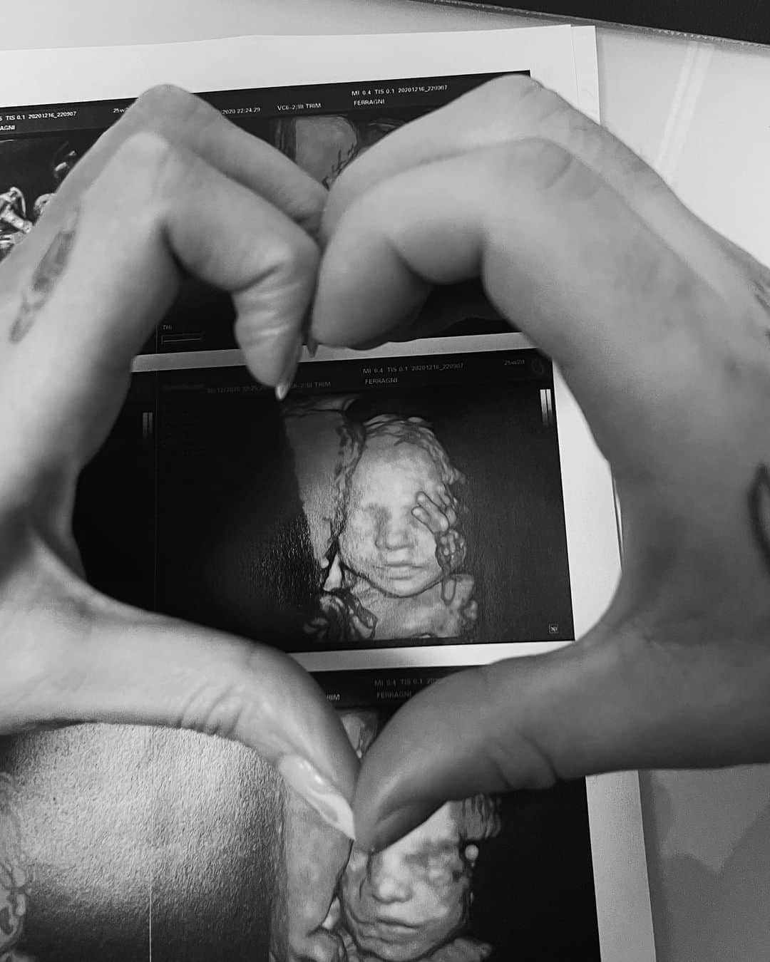 フェデスのインスタグラム：「Ciao amore 💝」