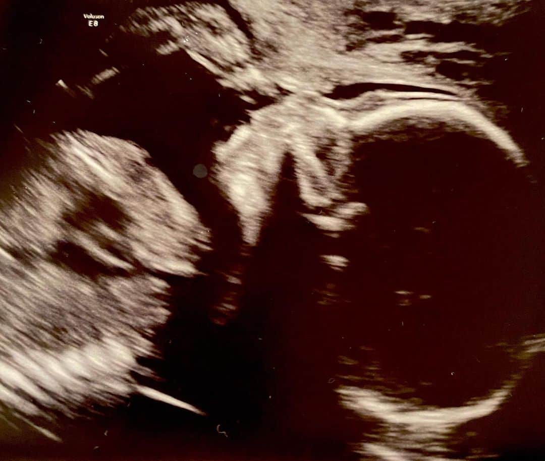 ディーナ・ニコール・コルテーゼのインスタグラム：「Baby Cameron is Looking a lot like his big brother in mommys belly 💙  Had our 20 week anatomy scan yesterday baby is growing and is doing well .. he’s a little squish .. all curled up with his feet by his head lol 😂   20 weeks and 4 days today 🥰 #boymom」