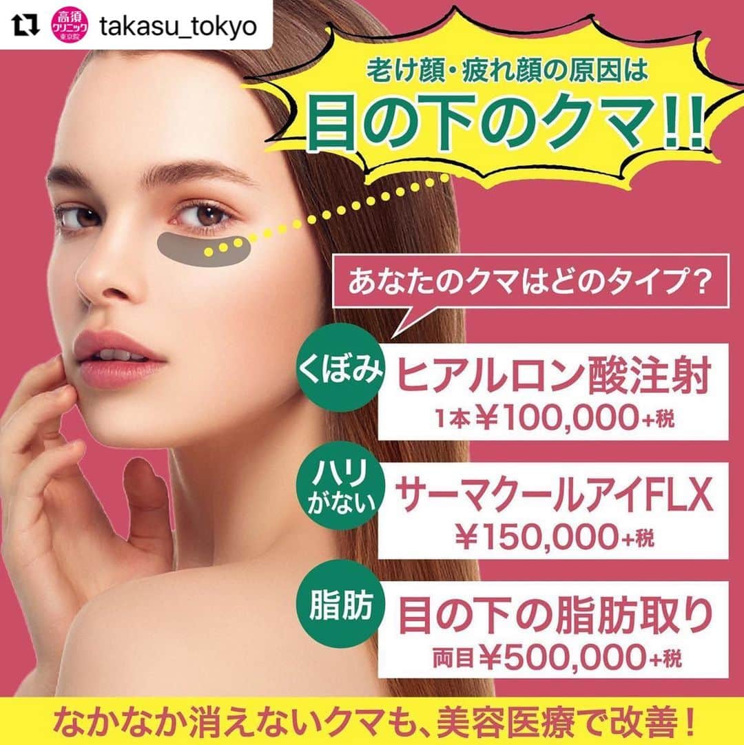 高須クリニックのインスタグラム：「. ━･･━･･━･･━･･━･･━･･━ #Repost @takasu_tokyo ━･･━･･━･･━･･━･･━･･━ いつも疲れているように見られ、年齢以上に老けて見える“クマ”。﻿ 化粧品やエステでは改善が難しいクマも、さまざまな美容医療なら改善することができます。﻿ 丁寧なカウンセリングであなたのクマのタイプを診断し、最適なメニューを選択しますので、まずはお気軽にご相談ください。﻿ ﻿ 【🌿料金】﻿ ●目の下のクマ治療﻿ ヒアルロン酸1本￥100,000（税抜）［全院］﻿ 脂肪除去 目の下（片目）￥250,000（税抜） ［東京・横浜・名古屋・大阪］﻿ 脂肪除去 目の下（両目）￥500,000（税抜） ［東京・横浜・名古屋・大阪］﻿ ﻿ ●サーマクールアイFLX﻿ ¥150,000（税抜）［全院］﻿ ﻿ 【⚠️副作用・リスク】﻿ ●目の下のクマ治療﻿ 内出血（注射針が血管に当たってしまった場合）、アレルギーが生じる可能性、注入後の感染、過度にいじったり揉んだりすると腫れる可能性﻿ ﻿ ●サーマクールアイFLX﻿ 肌のほてり・発赤（照射後／肌が弱い方・敏感肌の方）﻿ ﻿ 【ご予約・お問合せ】 ➿0120-5587-10 ※症例写真や施術に関するご質問なども上記までお願い致します。 ﻿ #高須クリニック　#高須克弥　#美容　#美容整形　#整形手術　#整形　#プチ整形　#整形したい　#美容外科　#美容クリニック　#かわいい　#可愛くなりたい　#綺麗　#綺麗になりたい　#美人　#美容好きな人と繋がりたい　#美容好き　#目もと　#目の下　#目の下のクマ　#クマ　#脂肪　#たるみ　#ヒアルロン酸　#サーマクールアイ　#エイジングケア　#ナチュラル　#eye」