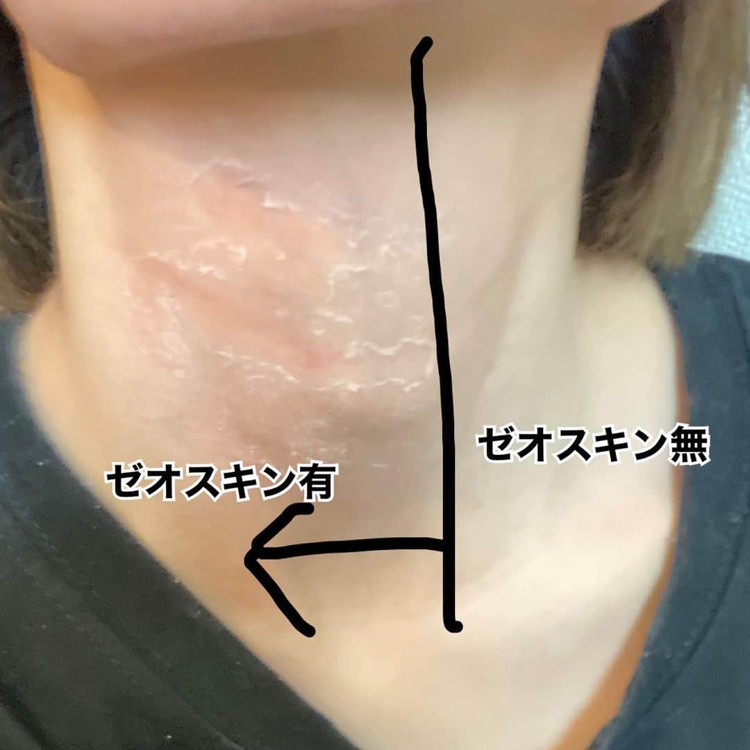 為近あんなのインスタグラム