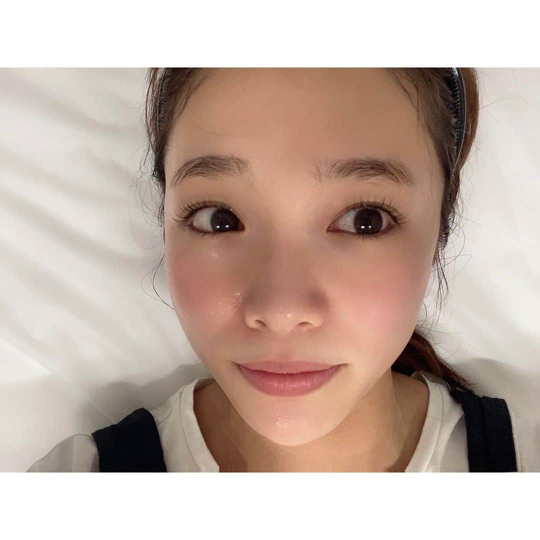 川村茉由さんのインスタグラム写真 - (川村茉由Instagram)「スキンケアを変えました！ 前から気になっていた 資生堂の『NAVISION DR』✨ 医療機関限定取扱商品 なんですが、ついに ヒメクリニックにやってきた🏥  さすが資生堂…使用感、 テクスチャーがすごくいい。 とろみがあって、肌にのせたら ぐんぐん入っていって、 スキンケアしたあとの肌が モッチモチ💕 メイクノリが抜群です😌  さらに！これからヒメクリで ナビジョンをイオン導入できる ようになるみたいなんですが、 今回はエレクトロポレーションを 使って導入してもらいました🥺 これが面白いくらいに入る!入る! 終わったあと、肌がかなり トーンアップ✨ 1番感じたのは毛穴の引き締め。 毛穴の黒ずみがパッと消えた！ 驚きです…😘  BBクリームもよかったから また使用感載せます〜😚  そして、新しいメニュー 「HIFU あごまわりケア」も やってもらいました🙋‍♀️ 顎下の脂肪溶解ハイフと 顎まわりのハイフシャワーの組み合わせ☀️ 1番気になっていた顎下が キュッとくぼんでいくの！ しかもハイフって痛いんだけど笑、 これは全く痛くない🧡 値段もお安めだから、 月一の施術にもおすすめ〜！  詳しくはヒメクリのインスタ、 ひめ先生のインスタを見てね😘 @himeclinic  @ann_himechan   #himeclinic #ヒメクリニック #スキンケア #navision  #ナビジョンdr #ナビジョン #資生堂 #イオン導入 #エレクトロポレーション #hifu #ハイフ」11月25日 15時03分 - mayupi_k