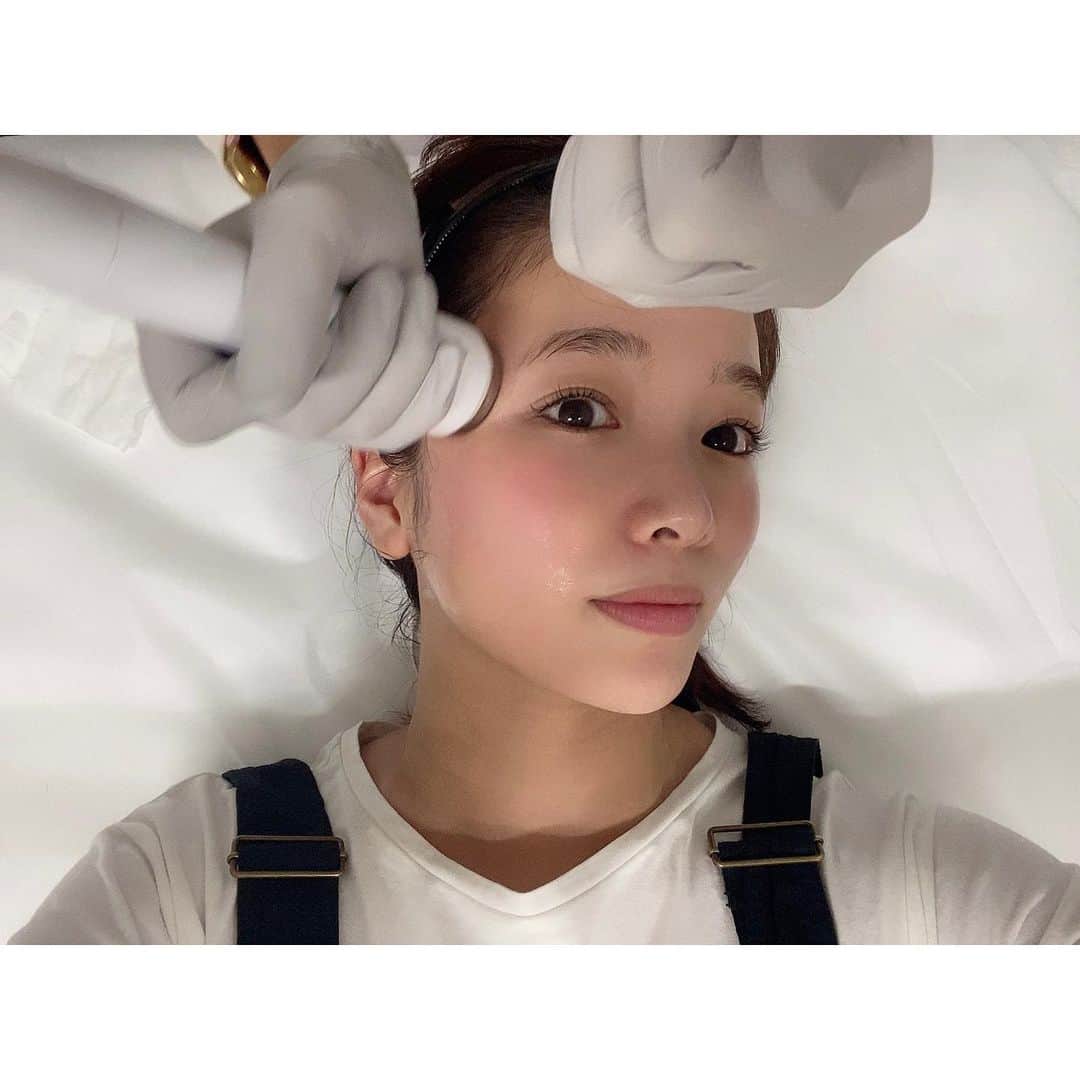 川村茉由さんのインスタグラム写真 - (川村茉由Instagram)「スキンケアを変えました！ 前から気になっていた 資生堂の『NAVISION DR』✨ 医療機関限定取扱商品 なんですが、ついに ヒメクリニックにやってきた🏥  さすが資生堂…使用感、 テクスチャーがすごくいい。 とろみがあって、肌にのせたら ぐんぐん入っていって、 スキンケアしたあとの肌が モッチモチ💕 メイクノリが抜群です😌  さらに！これからヒメクリで ナビジョンをイオン導入できる ようになるみたいなんですが、 今回はエレクトロポレーションを 使って導入してもらいました🥺 これが面白いくらいに入る!入る! 終わったあと、肌がかなり トーンアップ✨ 1番感じたのは毛穴の引き締め。 毛穴の黒ずみがパッと消えた！ 驚きです…😘  BBクリームもよかったから また使用感載せます〜😚  そして、新しいメニュー 「HIFU あごまわりケア」も やってもらいました🙋‍♀️ 顎下の脂肪溶解ハイフと 顎まわりのハイフシャワーの組み合わせ☀️ 1番気になっていた顎下が キュッとくぼんでいくの！ しかもハイフって痛いんだけど笑、 これは全く痛くない🧡 値段もお安めだから、 月一の施術にもおすすめ〜！  詳しくはヒメクリのインスタ、 ひめ先生のインスタを見てね😘 @himeclinic  @ann_himechan   #himeclinic #ヒメクリニック #スキンケア #navision  #ナビジョンdr #ナビジョン #資生堂 #イオン導入 #エレクトロポレーション #hifu #ハイフ」11月25日 15時03分 - mayupi_k