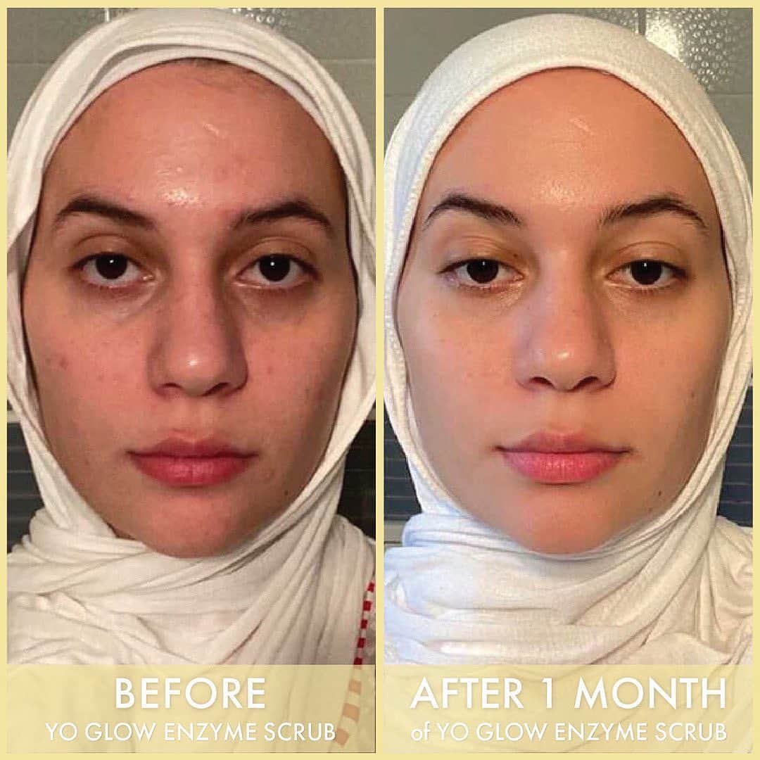 Huda Kattanさんのインスタグラム写真 - (Huda KattanInstagram)「These @wishfulskin before and afters 😱😍 💚 @monakattan's SNATCHED jawline just minutes after using CHIN LIFT  💛 GLOWING @fayza_toutanji's using Yo Glow  💖@souhailalaghmiri's incredible transformation using Rose Oil What skincare product do you want us to launch next? Last chance to get 20% off #WISHFUL products my loves! Love you all so much #wishfulblackfriday」11月27日 17時53分 - hudabeauty