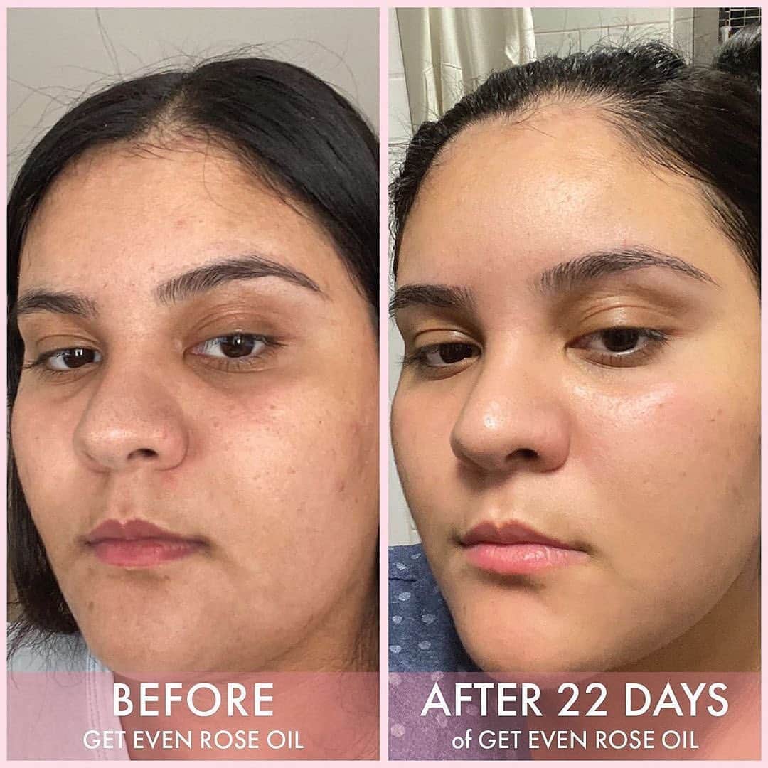 Huda Kattanさんのインスタグラム写真 - (Huda KattanInstagram)「These @wishfulskin before and afters 😱😍 💚 @monakattan's SNATCHED jawline just minutes after using CHIN LIFT  💛 GLOWING @fayza_toutanji's using Yo Glow  💖@souhailalaghmiri's incredible transformation using Rose Oil What skincare product do you want us to launch next? Last chance to get 20% off #WISHFUL products my loves! Love you all so much #wishfulblackfriday」11月27日 17時53分 - hudabeauty