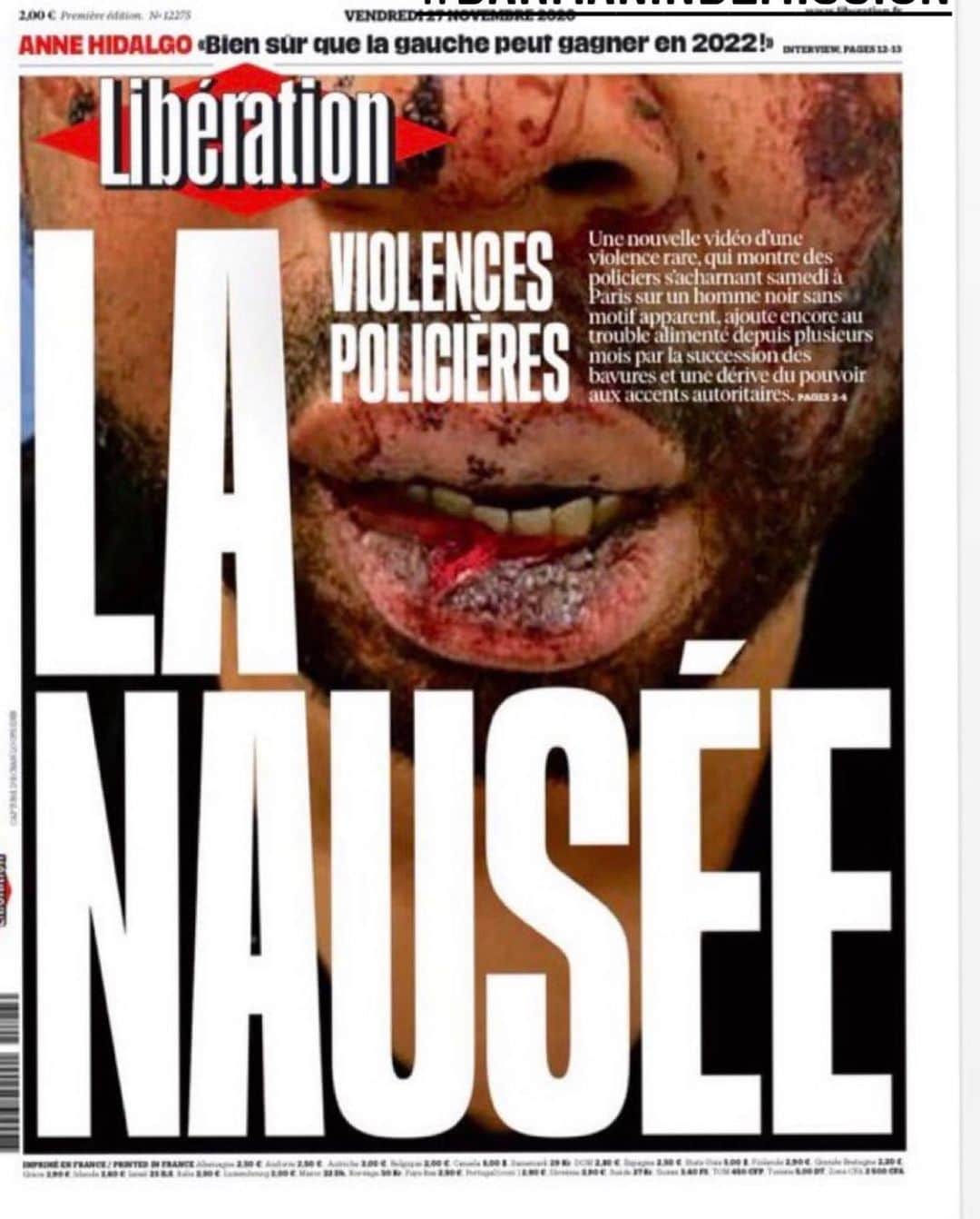 ヤスミン・アル＝マスリーのインスタグラム：「A black French man.. Music producer was attacked in his studio in Paris on November 21st and beaten to blood and called the N word by private mercenaries that the French police pay to do their dirty work.. there is one word to call all that #racist #criminal #illegal #notok not in the country that adopted me as a refugee and taught me that being French is about three things #égalité #equality #franternité #brotherhood #liberté #freedom .. I am sad heart broken.. I wish I was in paris now .. sending my love to my French brothers and sisters who feel that what is happening do not represent them ! @liberationfr  #france .. #policebrutality #policebrutalityawareness」