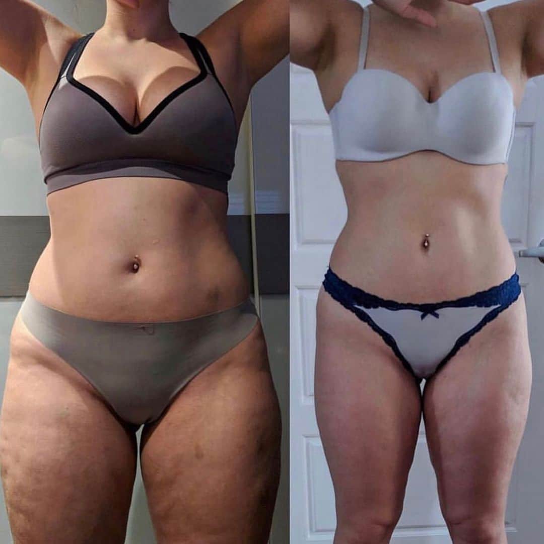 Ainsley Rodriguezさんのインスタグラム写真 - (Ainsley RodriguezInstagram)「🎉 Drop some love for my client Lisa after 4 weeks with me 👇🏻!! - 4 weeks down and WOW can we say buh-bye cellulite!! I am SO proud of all my clients this month!! Don’t miss out on coaching spots for next week! DM your e📬 for info! 💪🏻 . ✅ You can NOW pay in 4 interest-free installments as well instead of all upfront」11月29日 1時06分 - ainsley