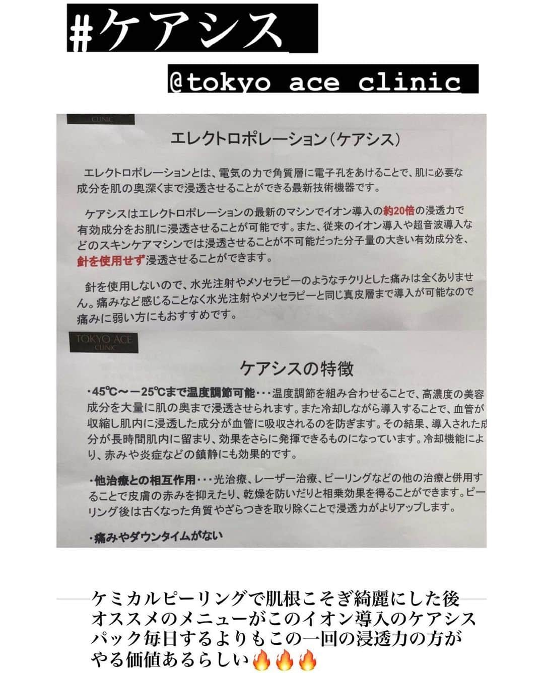 照井和希さんのインスタグラム写真 - (照井和希Instagram)「12/2にオープンのTOKYO ACE CLINIC心斎橋院で ケミカルピーリングとケアシスをして来たよ✌🏾 ひと足早く施術受けさせてもらいました🔥  《 @tokyo_ace_clinic 》  ☑︎ケミカルピーリング ニキビ、ニキビ跡、毛穴の黒ずみに効果あり◎ 乱れた肌のターンオーバーのサイクルを正常に戻して、 まるで生まれ変わったようにワントーン明るいツヤ肌へと導きます  ☑︎ケアシス  イオン導入の20倍の浸透力がある。#強い パック40回するよりケアシス1回の方が効果的 #強い ケアシスで肌の奥まで薬剤を導入してもらいました！ 施術後にほてった肌を冷却しながら薬剤を導入する事で より赤みの軽減にもなるからセットでやった方が効果的みたい🙏🏽✨  『 ケミカルピーリング＆ケアシス 』 🟠毛穴の開きが気になる 🟠ニキビ肌、ニキビ跡をきれいにしたい 🟠肌のキメを整えたい 🟠肌のくすみを改善したい 🟠そばかすが気になる  人にオススメのセットメニューでございます✌🏾㊗️ マスクする様になって肌荒れしたりニキビ出来て ニキビ跡になってた箇所もあったし肌見るたびに 萎えてたし 鏡も割ってたので (それは嘘)   定期的にプロの手借りて美肌治療の大切さ実感… とにかく施術後の肌がちゅるんちゅるん過ぎて(´；ω；`) ポツポツ感もゴワつきもない嬉しい(´；ω；`) つやつやちゅるちゅる肌頑張って保つ(´；ω；`)  とにかくほっぺたの毛穴がマジでやばくて 目立ち出したのでコンプレック過ぎてダーマペンとかも気になって 気になって気になって仕方ない事先生に伝えたら めちゃくちゃ丁寧にカウセしてくれた(´；ω；`) 色んな治療法あるなぁ…自分に合ったもの また一旦考えて出直します(´；ω；`)  韓国アイドルたちみたいな 爆上げ美白透明感肌になりた過ぎるんや(´；ω；`) 顔面土色運動場から一歩踏み出せた照井でした ケミカルピーリングとケアシスめちゃくちゃオススメです。震  #tokyo_ace_clinic #美容皮膚科 #ケアシス #保湿 #ツヤ肌 #ケミカルピーリング #ピーリング #アンチエイジング #美容 #美容垢 #美肌 #美肌ケア #美容クリニック #心斎橋 #難波」11月29日 23時59分 - kazu24ki