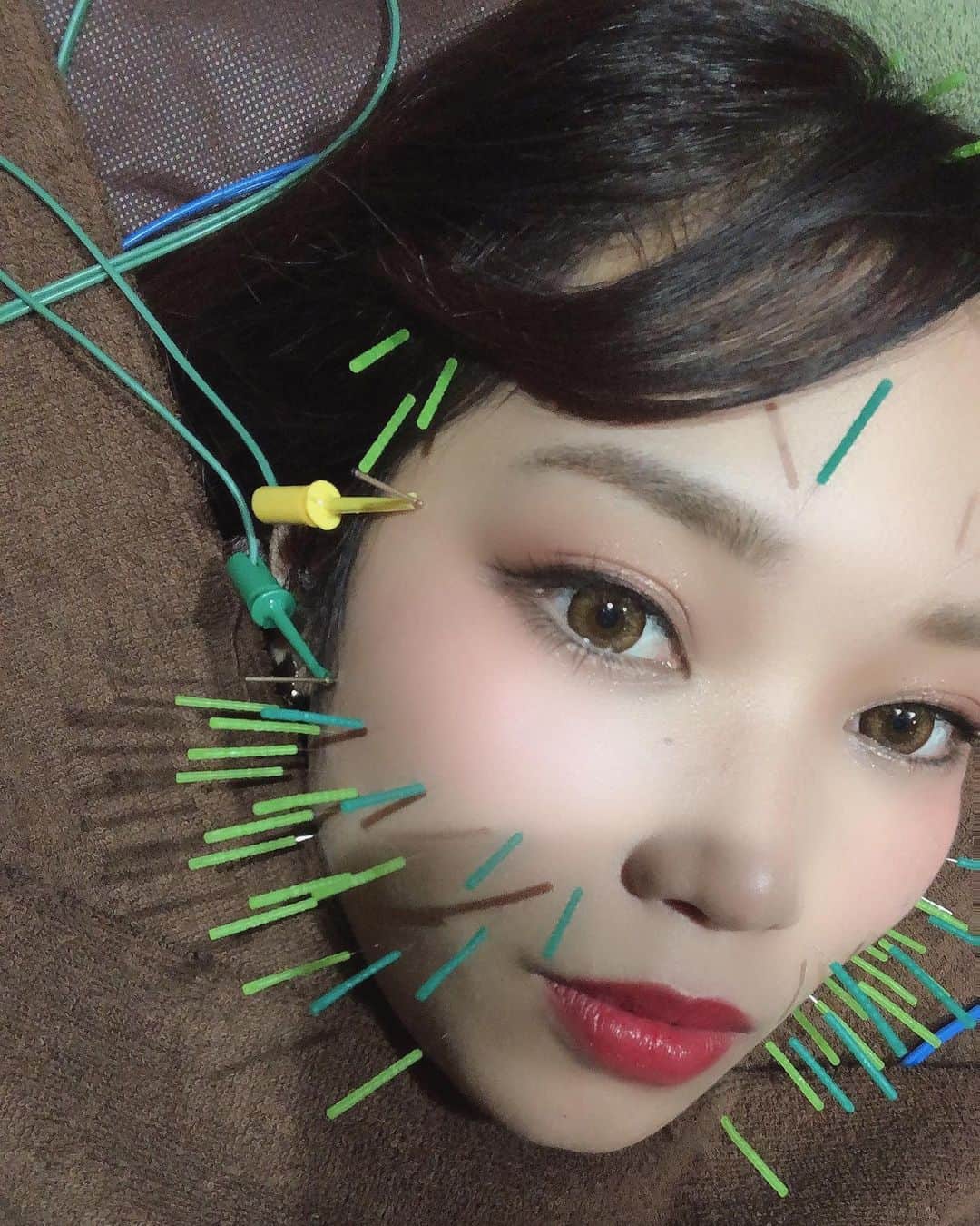 R!Nのインスタグラム：「おひさし美容鍼！  ここ最近全然行けていなかった美容鍼に行ってきました✨ ライブも決まっているし、セルフメンテ少しずつ復活しております。  いつもお世話になっている杉崎先生、 何も言わずとも顔の状態や健康状態をゴッドハンドで感じ取ってテキパキと施術してくれて毎度毎度感動しております🥲🌈  きゅっと輪郭もシャープになったしここ最近酷かった頭痛へのアドバイスも頂いたので日頃からのケアもがんばります！◎  #きゅきゅっと美容鍼  #bcarat式美容鍼 #bcarat #杉崎先生 #美容鍼 #美意識向上 #セルフメンテ #メンテナンス #beauty #美 #追求 #リフトアップ #小顔」