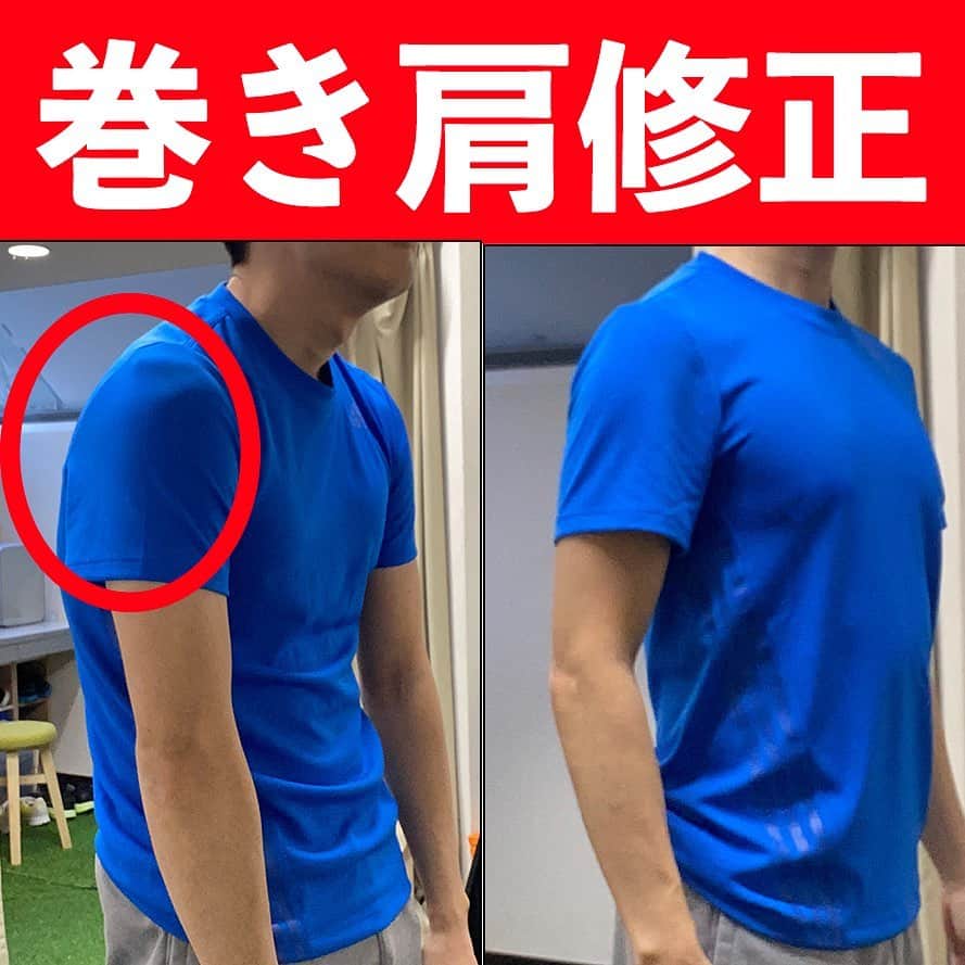 ととのえて、からだ。@渋谷発パーソナルトレーニングジムのインスタグラム：「巻き肩さんは肩甲骨下げる癖をつけよう！  こんばんは、こんさんです✨  今年は多くの方が家でのリモートワークとなり、肩こりや首コリに悩まされてきたのではないでしょうか？  そんな中、姿勢の悩みで非常に多くなっているのが「巻き肩」です💀  これは、  ・肩甲骨が外側に開き  ・肩甲骨が上に上がっている  状態でなります。  この状態で固まっているので、  ・胸の筋肉を丁寧にストレッチして、肩甲骨の動きを出しやすくする準備をする  ・肩甲骨を下げながらのストレッチをする  ・しっかり肩甲骨を動かす（寄せる動き、下げる動き）  この下げる動きというのは「バンザイ🙌」の動きで出来ます。  ので最後のエクササイズにはそれを取り入れました✨  ぜひこの3ステップでお手軽巻き肩解消をしていきましょうね～！  首コリ肩こりの悩み、ありますかね？コメントでお身体の悩み聴かせてくださいね😊」